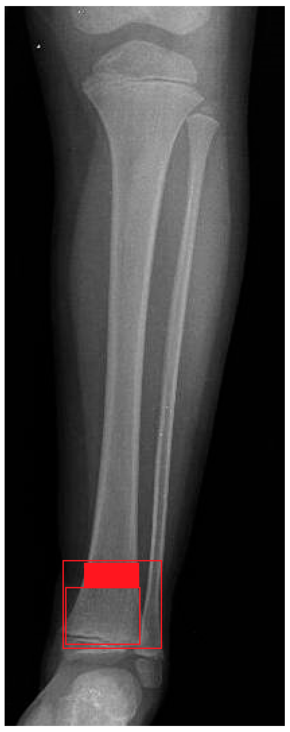 Children 12 01345 g001