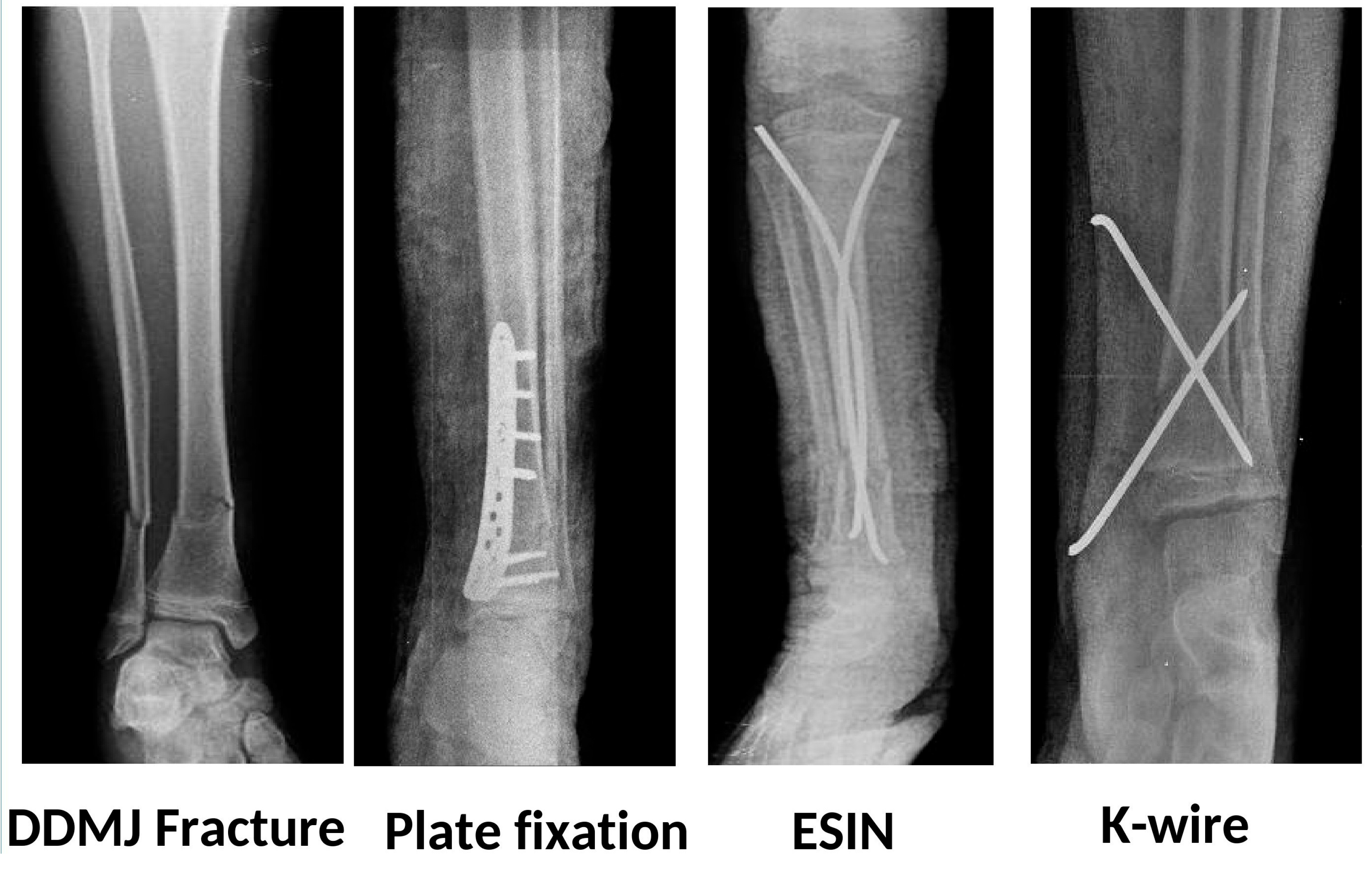 Children 12 01345 g002