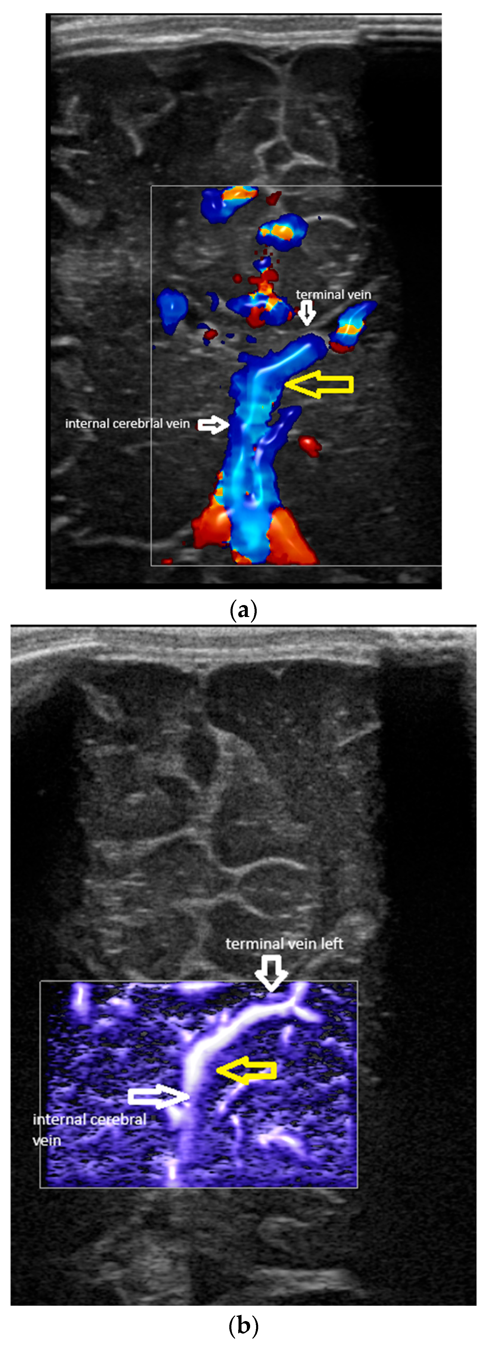 Children 12 01347 g003a Children 12 01347 g003a