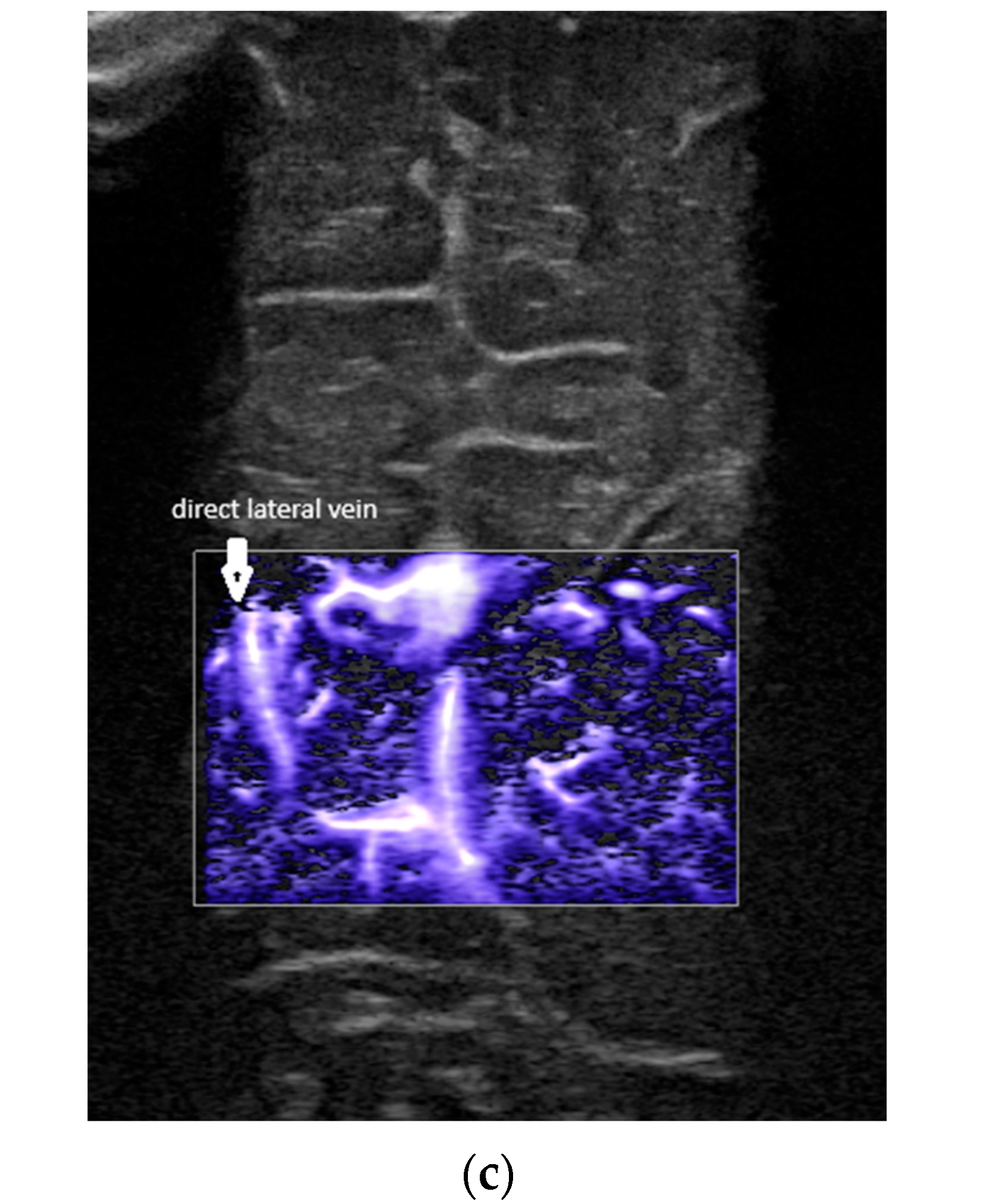 Children 12 01347 g003b Children 12 01347 g003b