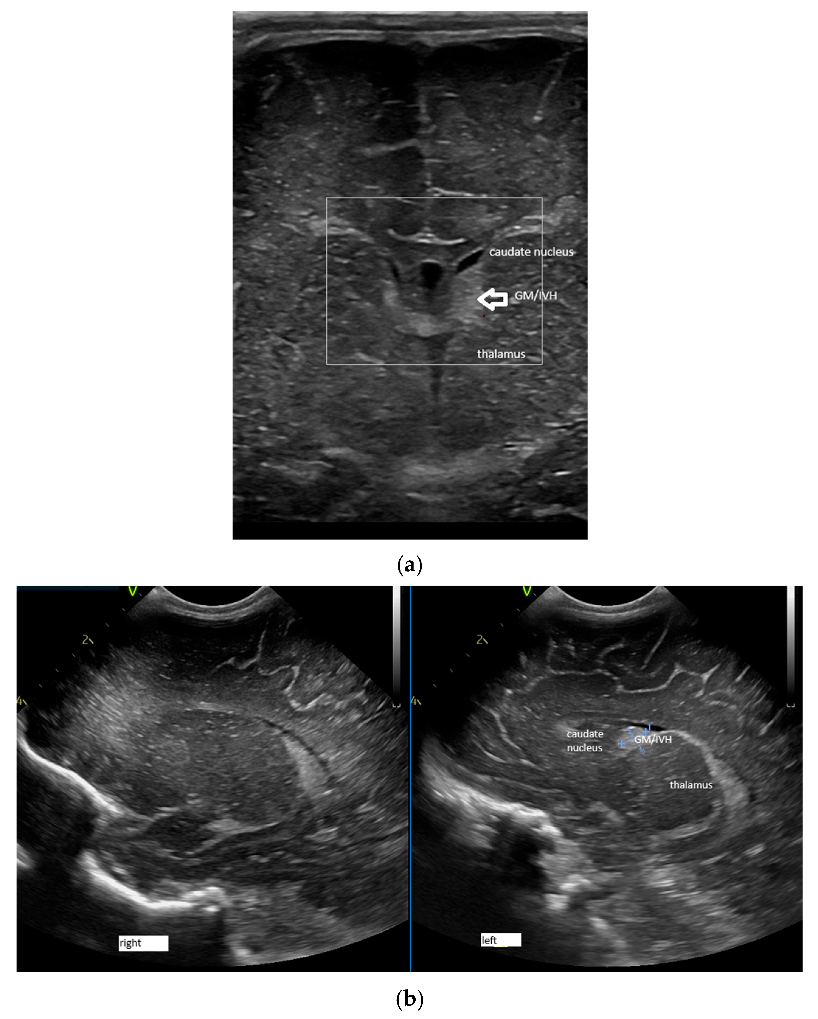 Children 12 01347 g004 Children 12 01347 g004
