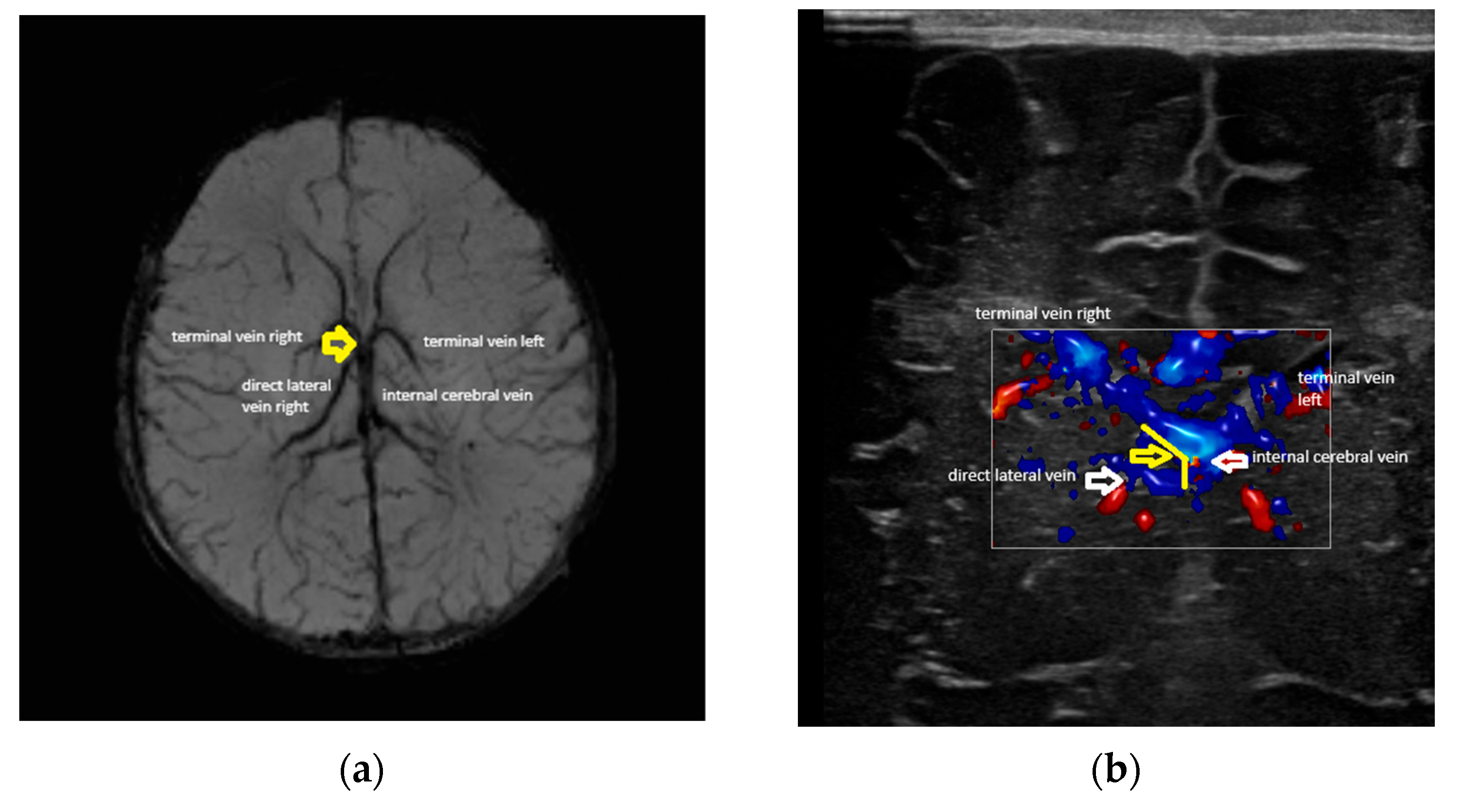 Children 12 01347 g005 Children 12 01347 g005