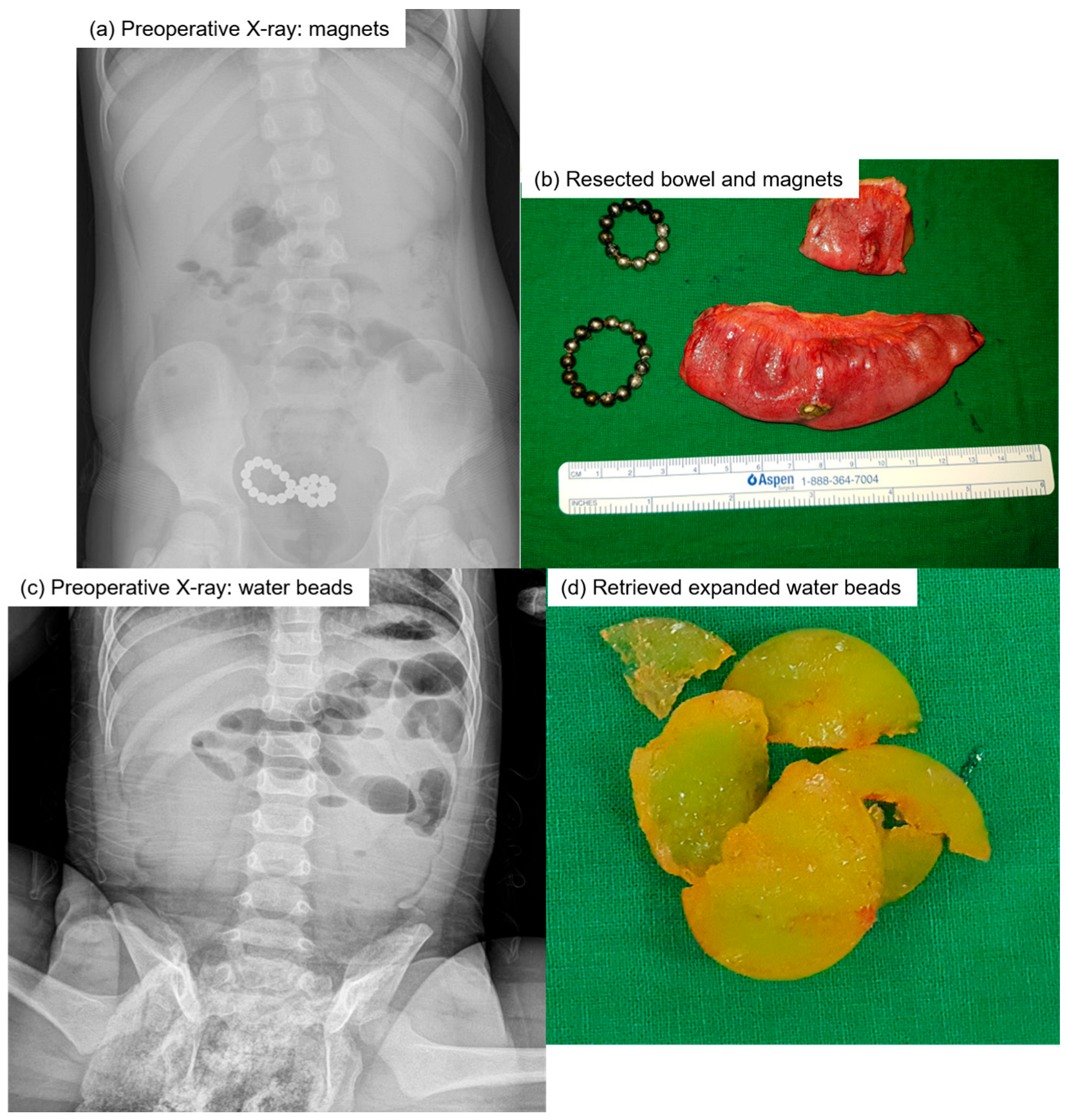 Children 12 01355 g001 Children 12 01355 g001