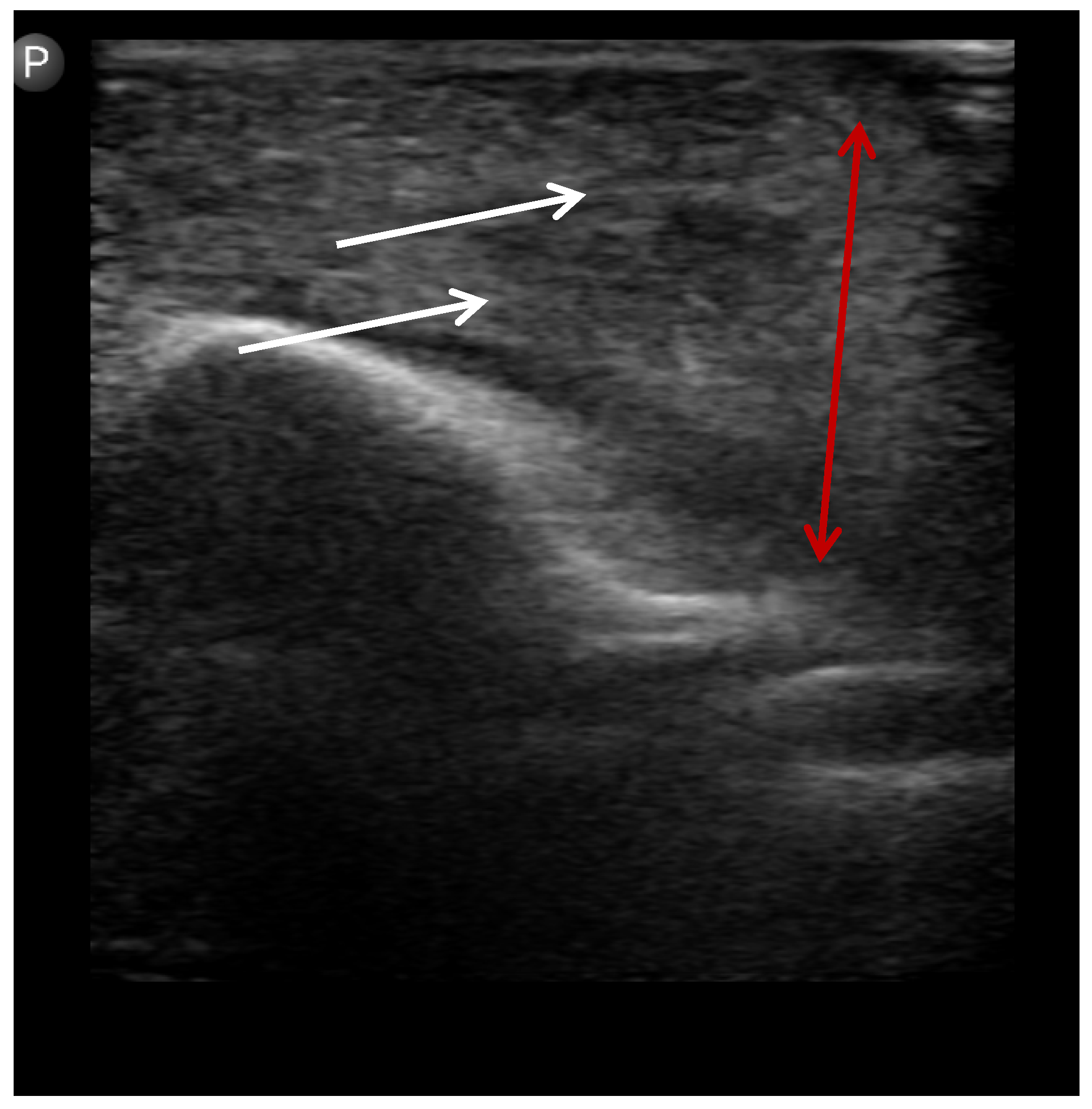 Children 12 01392 g003