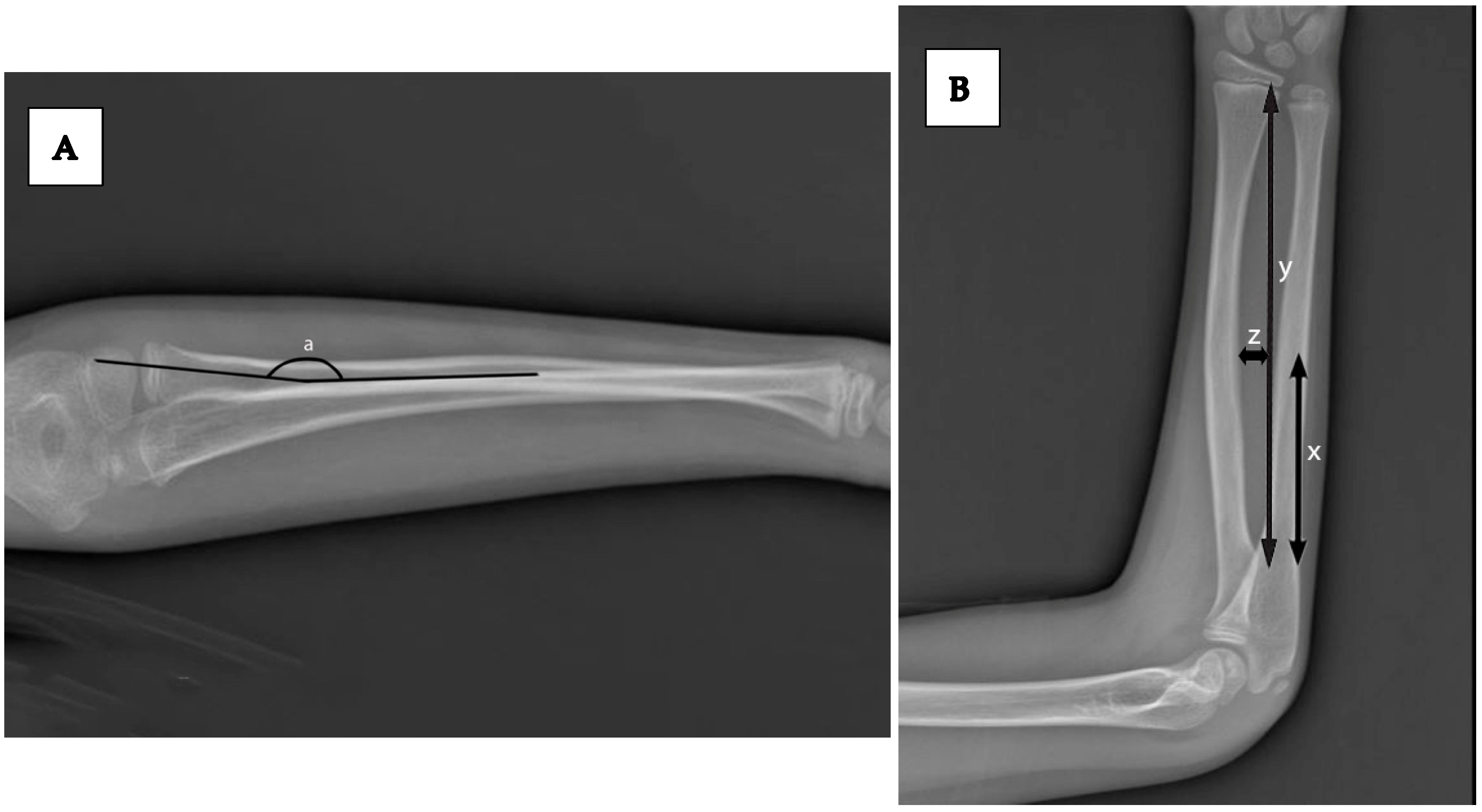 Children 12 01404 g002