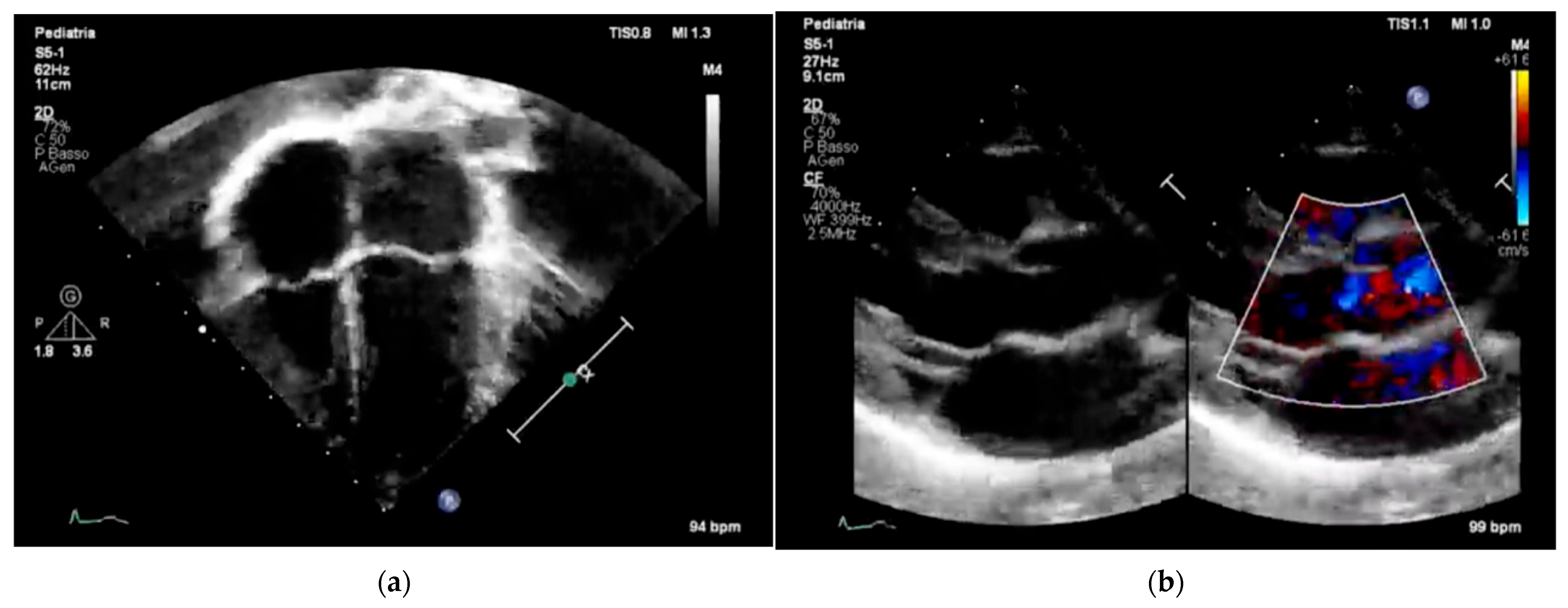 Children 12 01468 g003