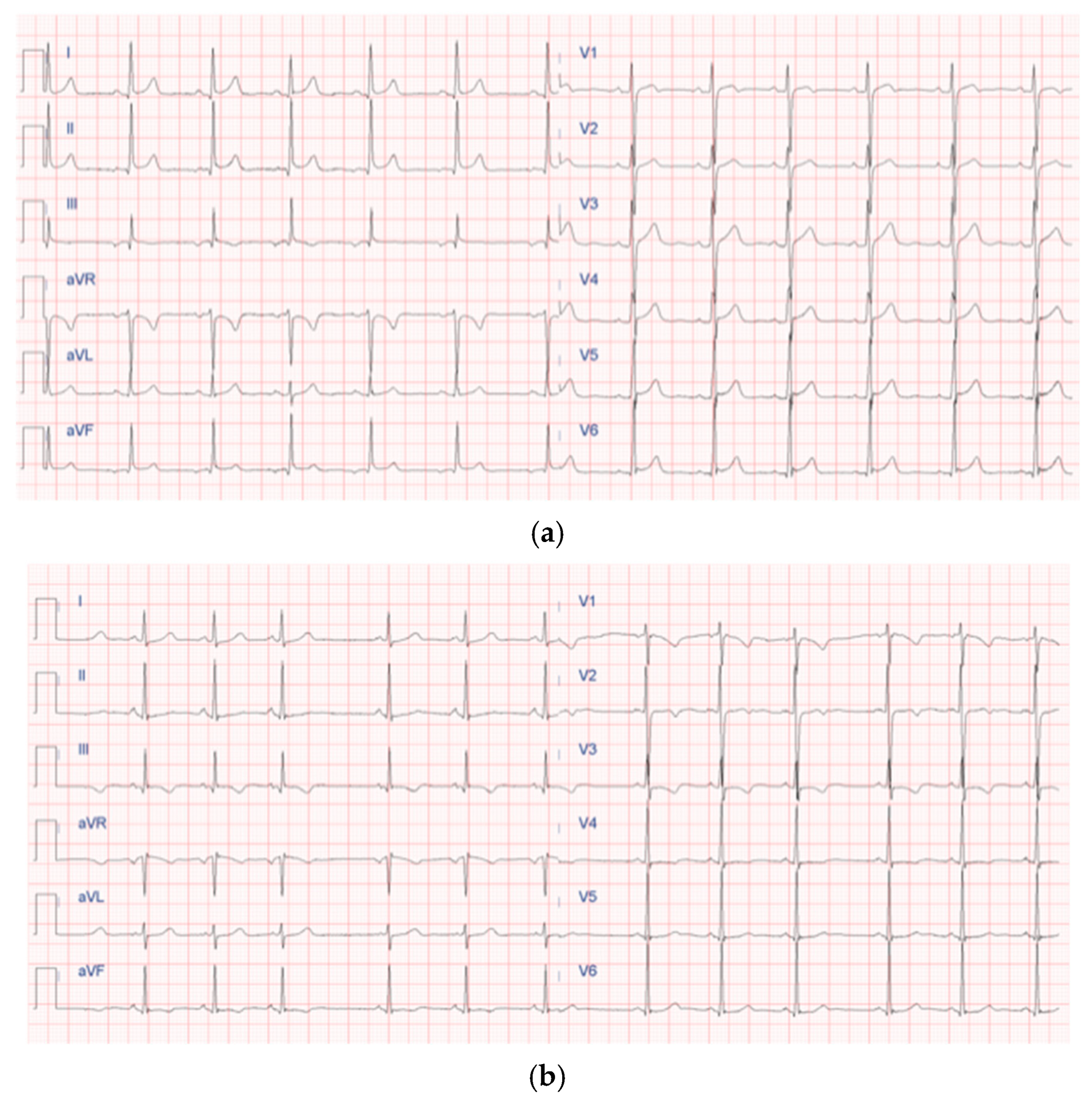 Children 12 01468 g004