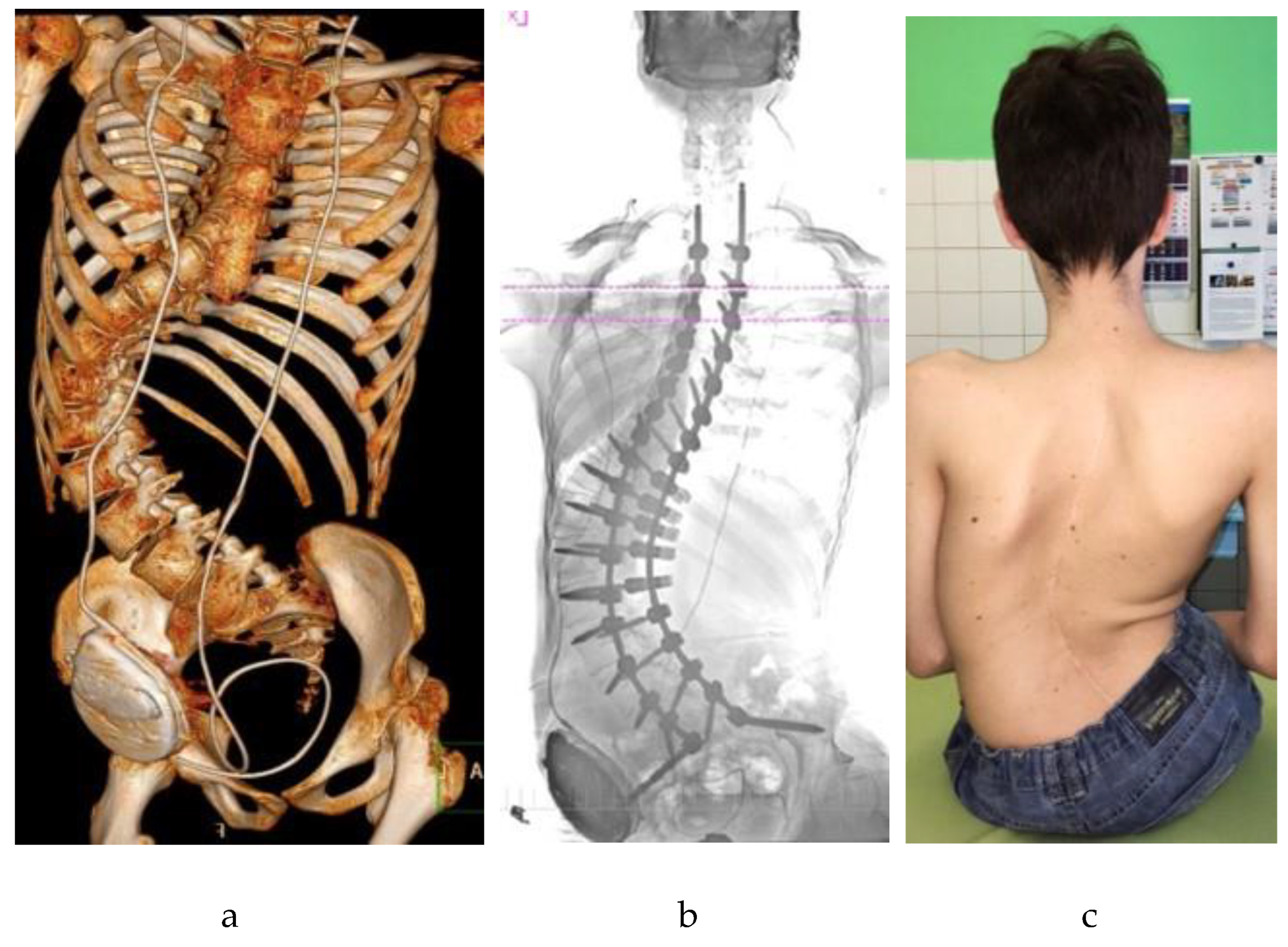 Children 12 01481 g001 Children 12 01481 g001