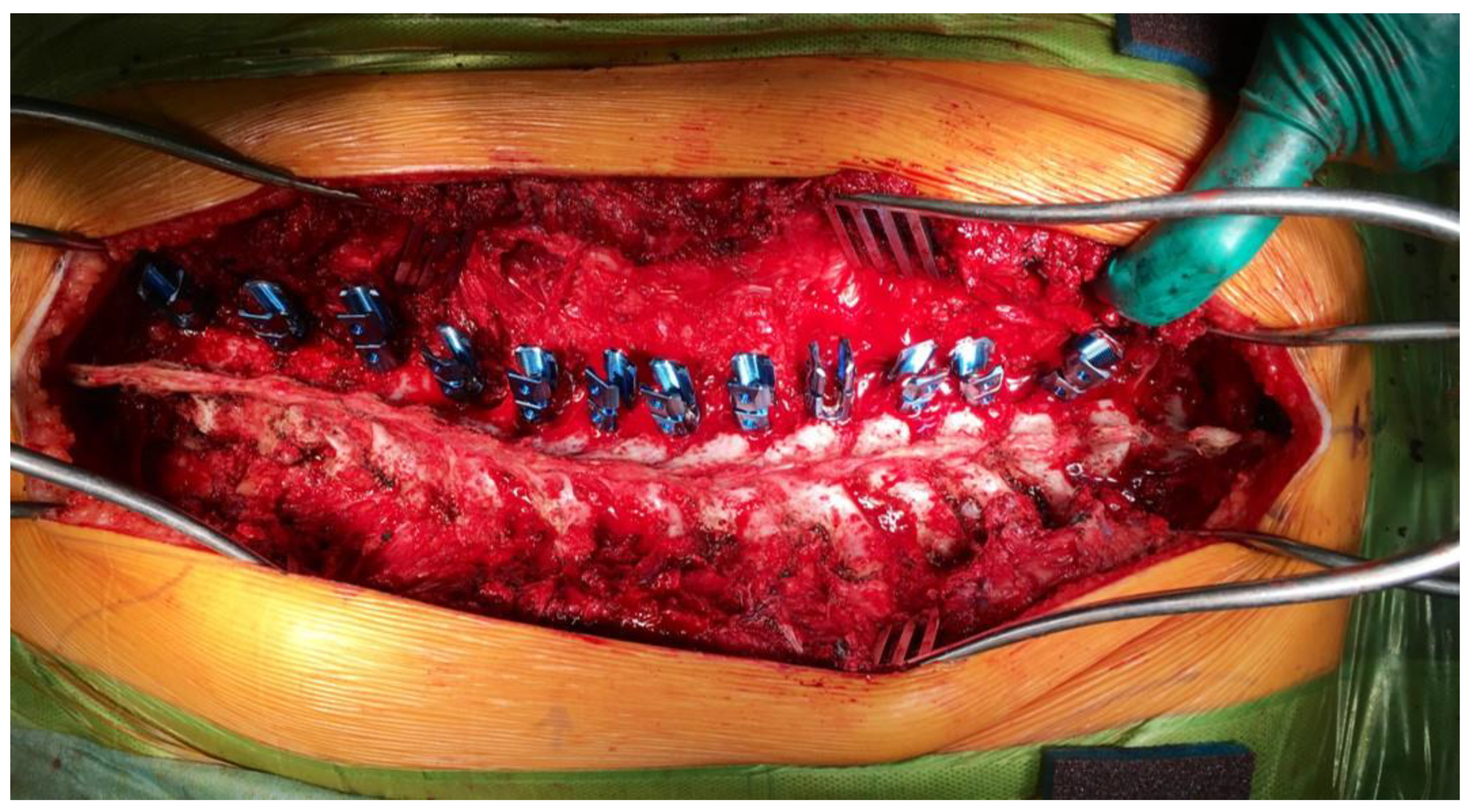 Children 12 01481 g004 Children 12 01481 g004