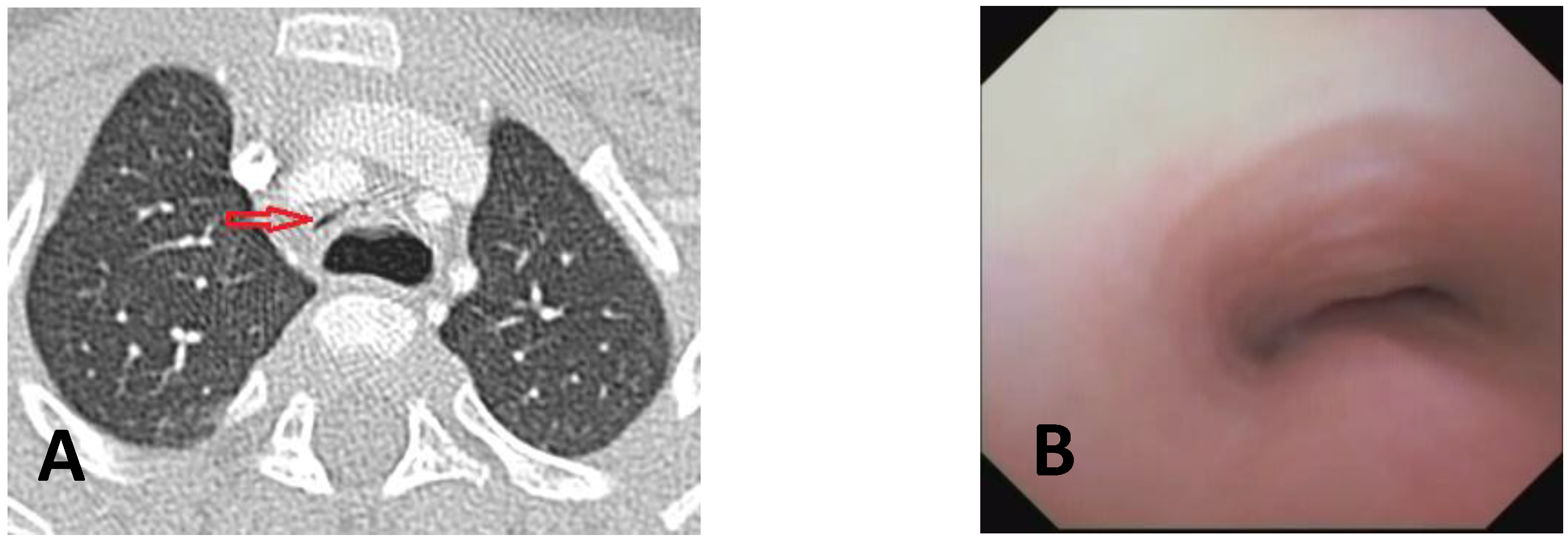 Children 12 01511 g011 Children 12 01511 g011