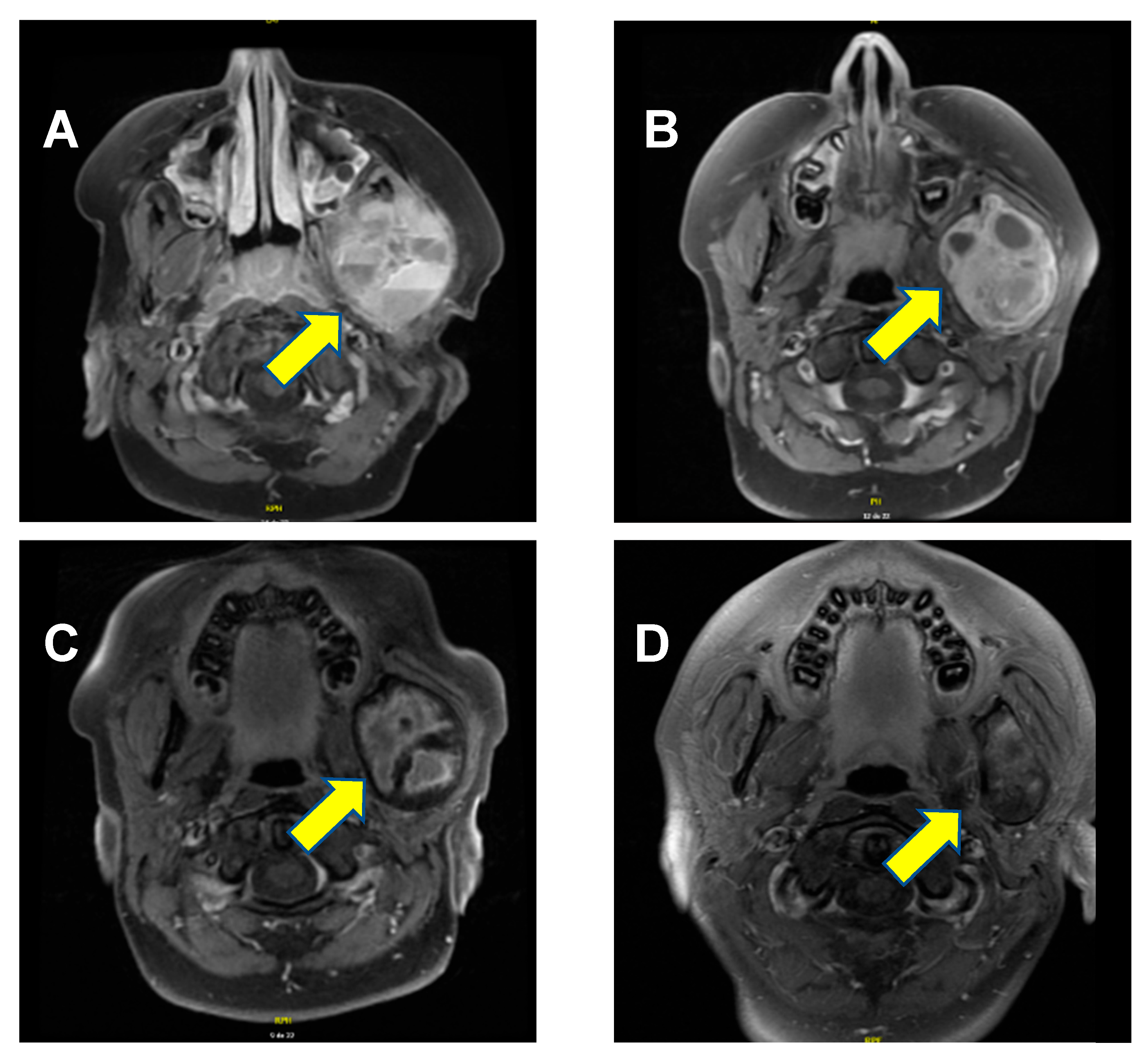 Children 12 01524 g001