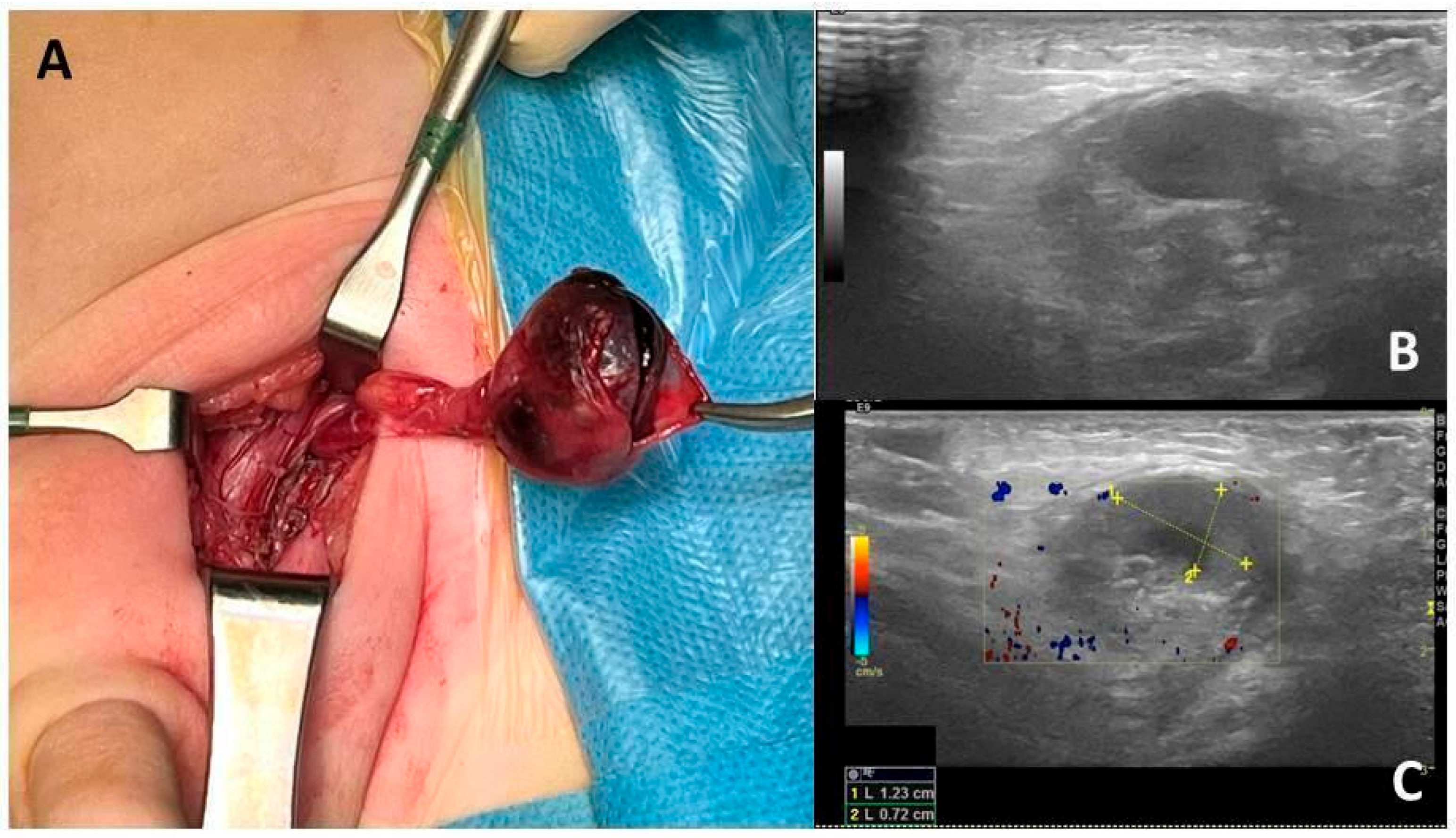 Children 12 01531 g001