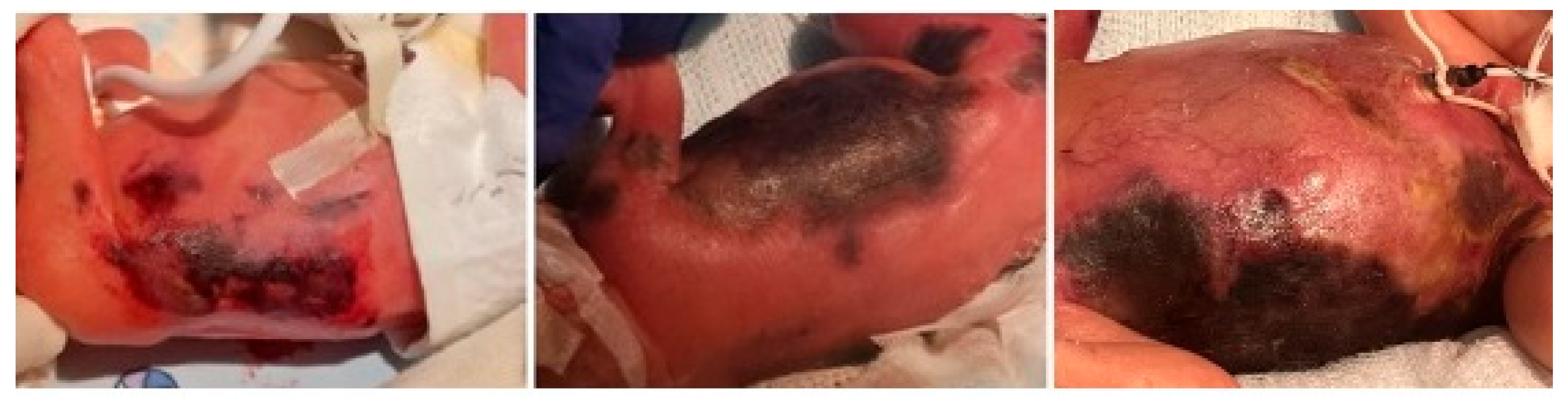 Children 12 01546 g001