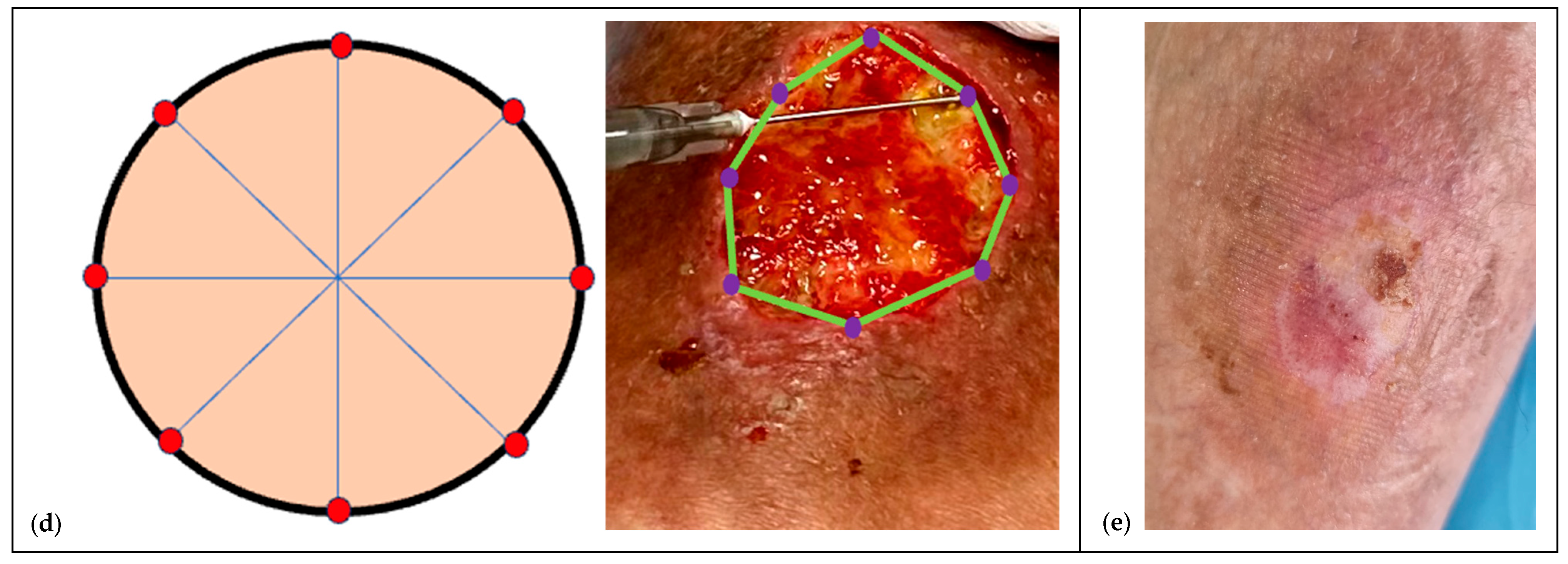 Children 12 01554 g001b