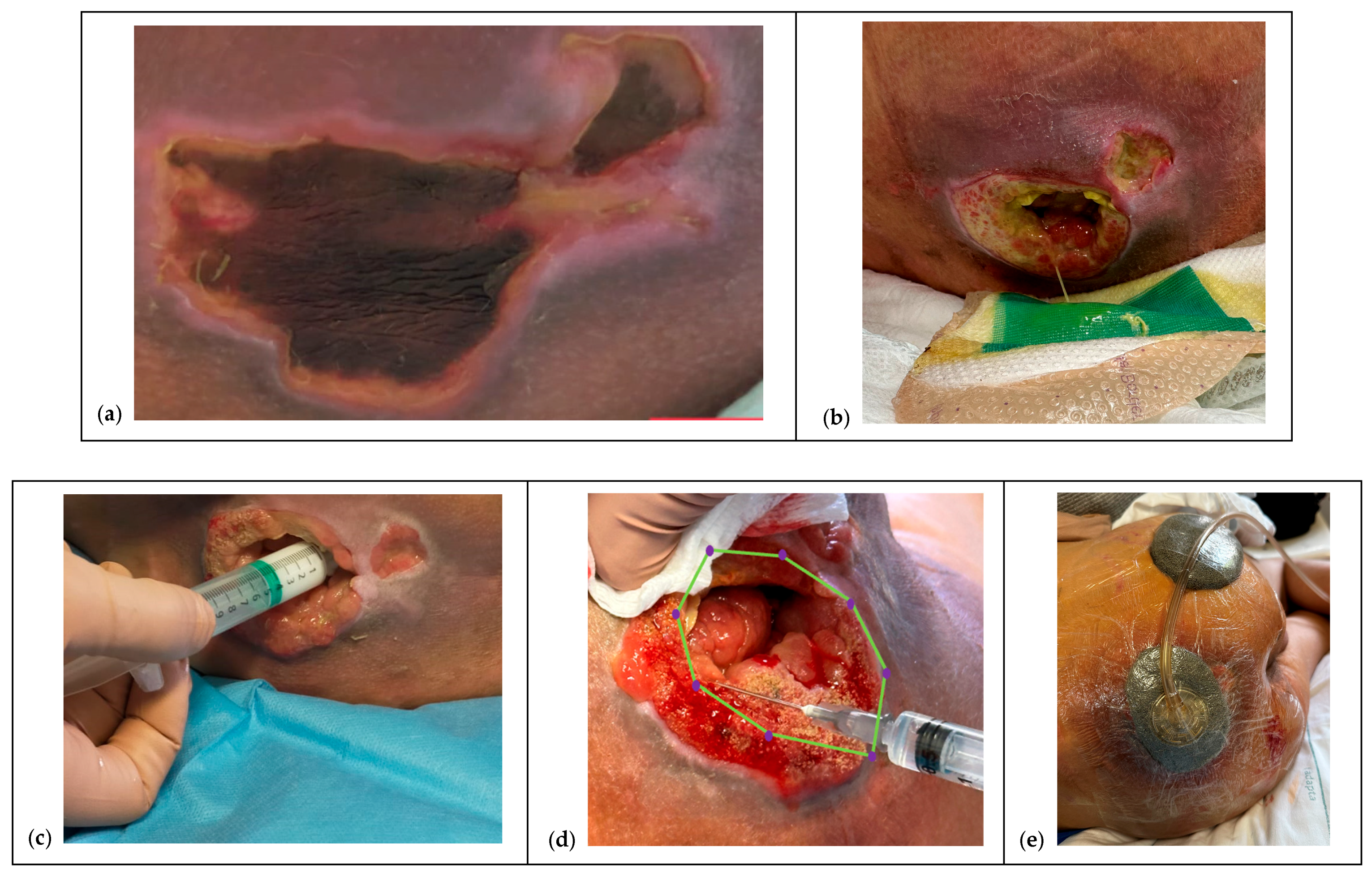 Children 12 01554 g002a