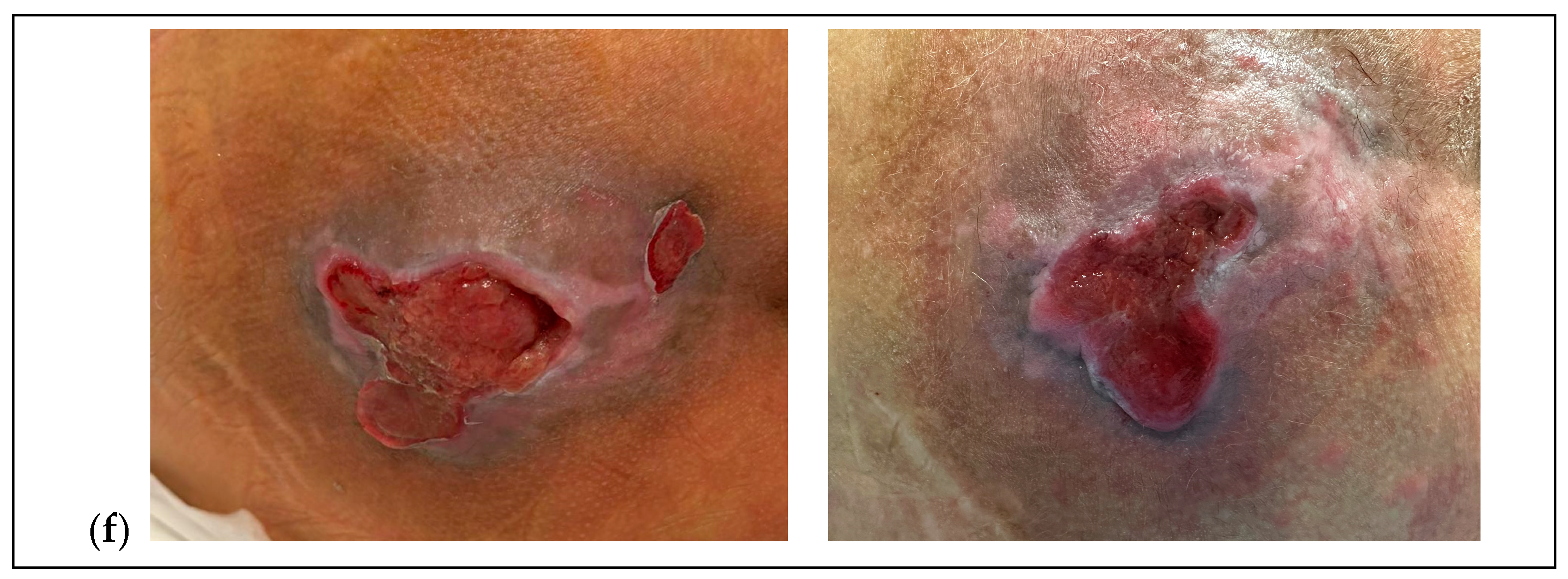 Children 12 01554 g002b