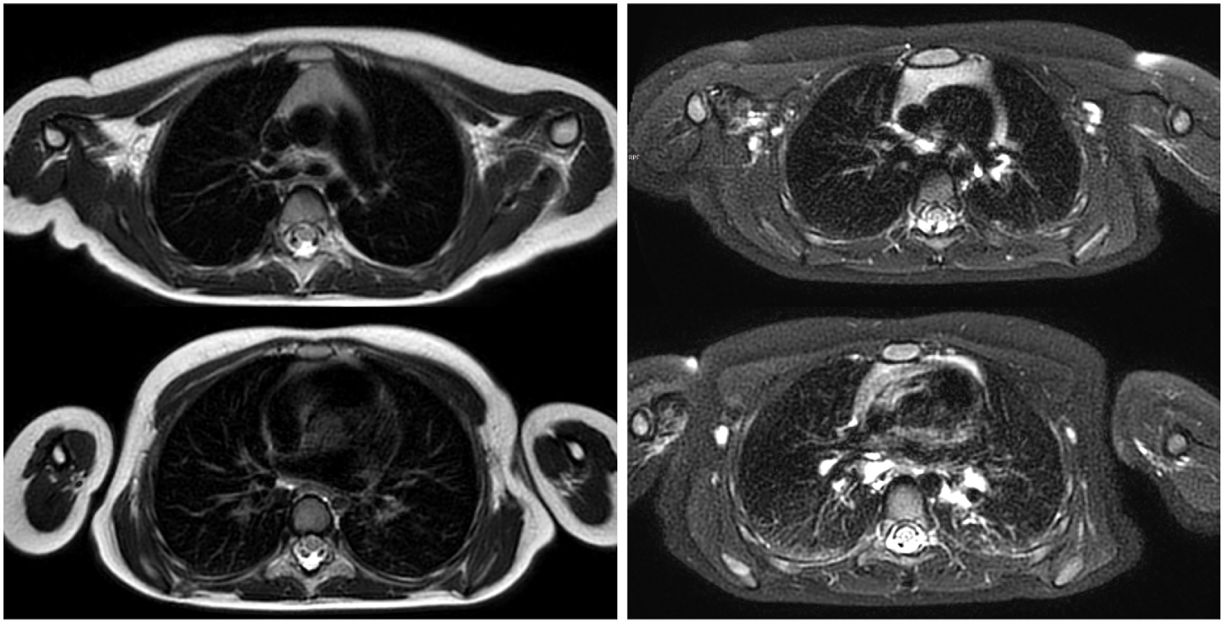 Children 12 01576 g001