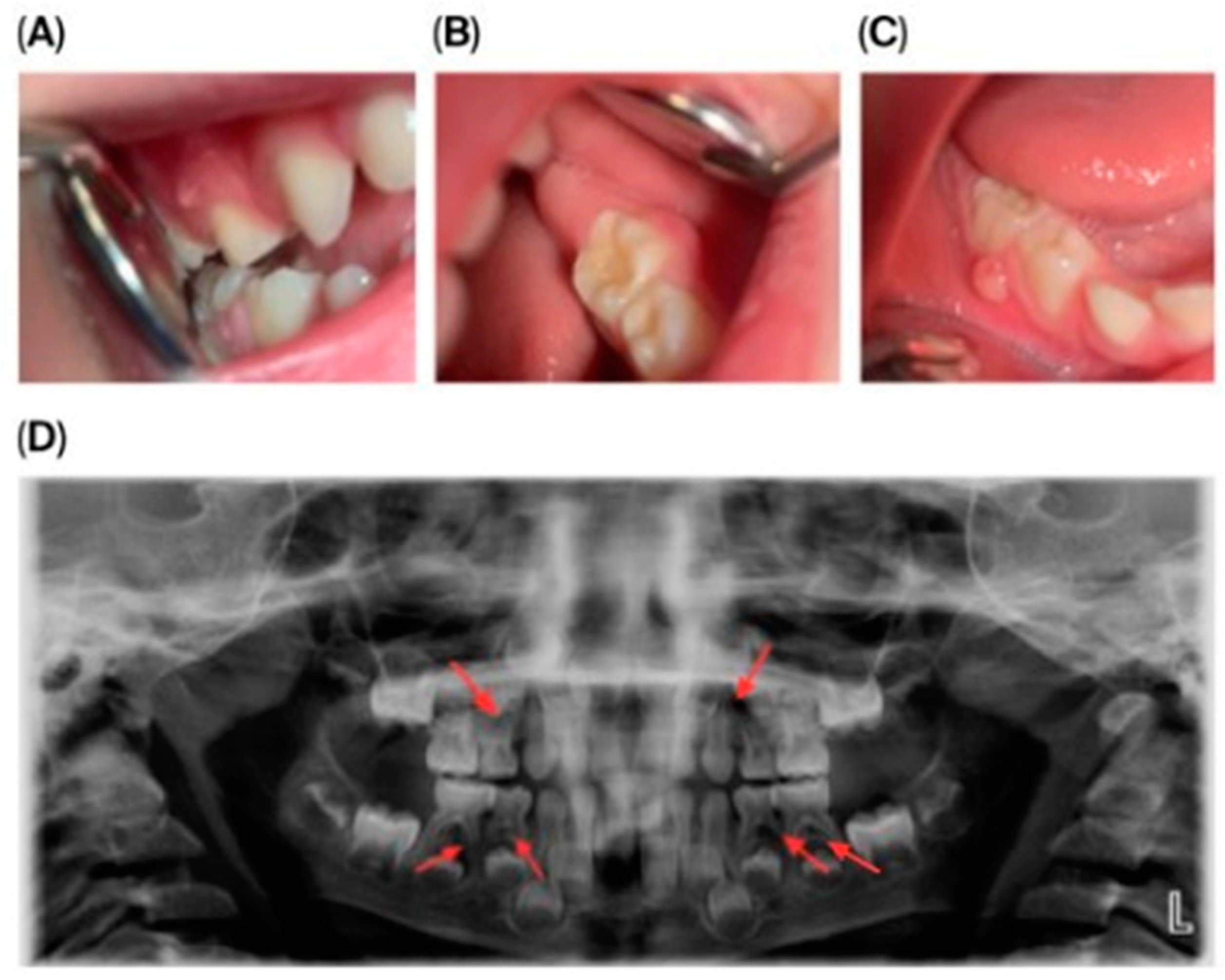 Children 13 00016 g001