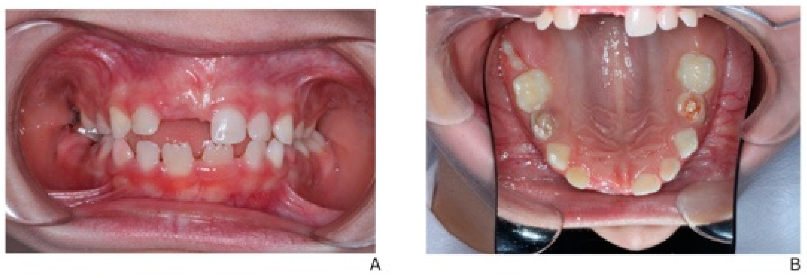 Children 13 00016 g005