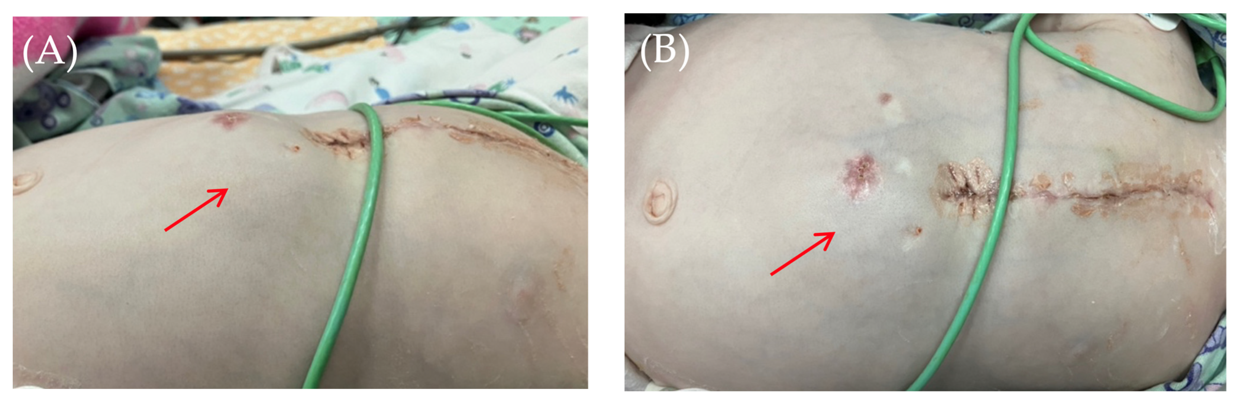 Children 13 00018 g001