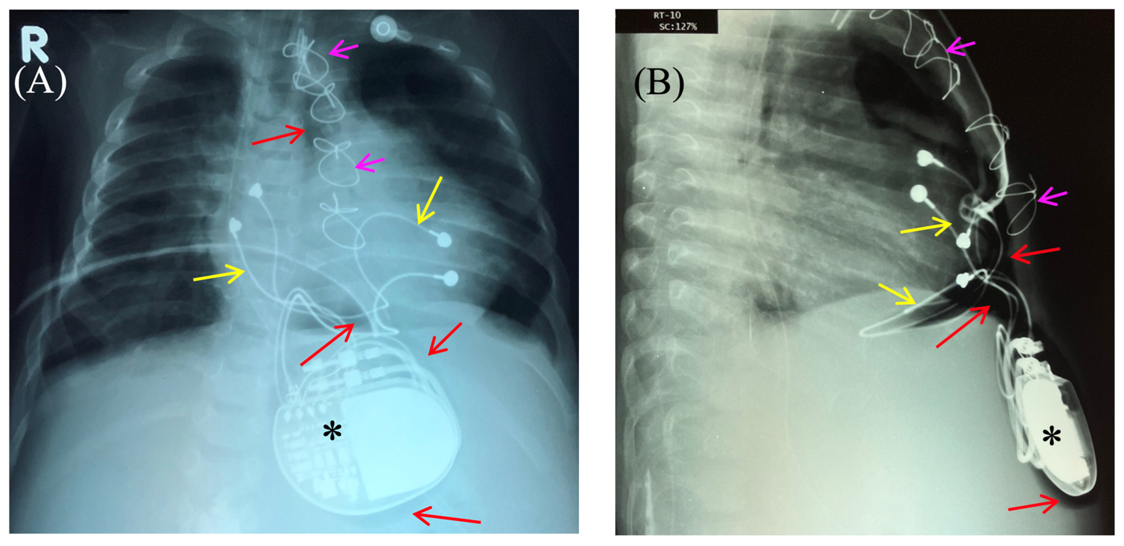 Children 13 00018 g002