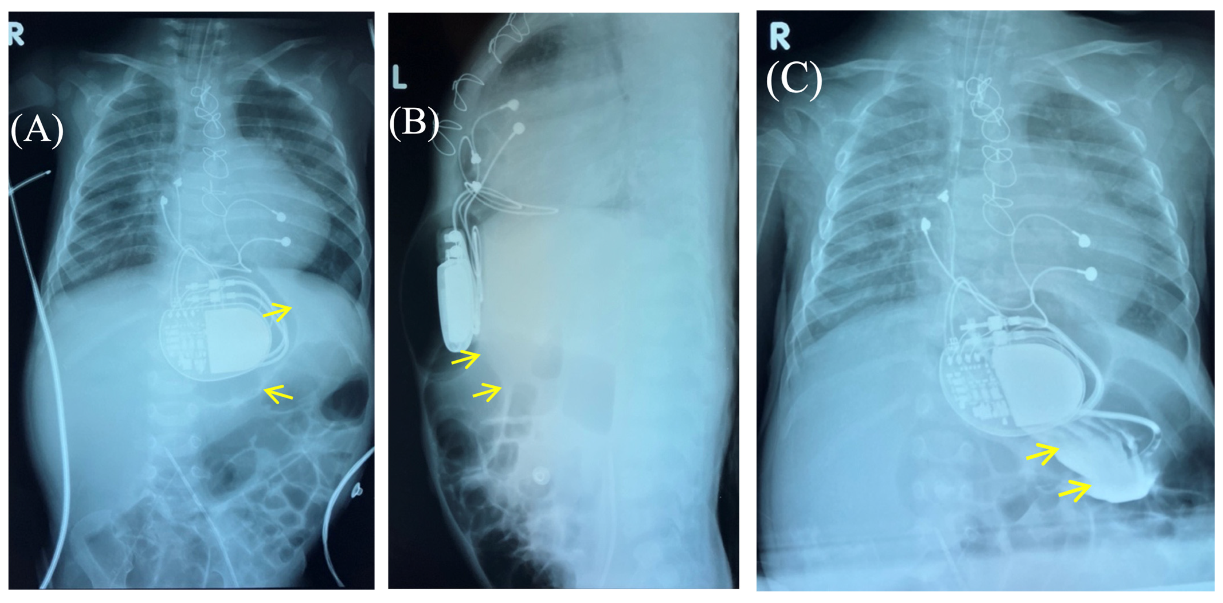 Children 13 00018 g003