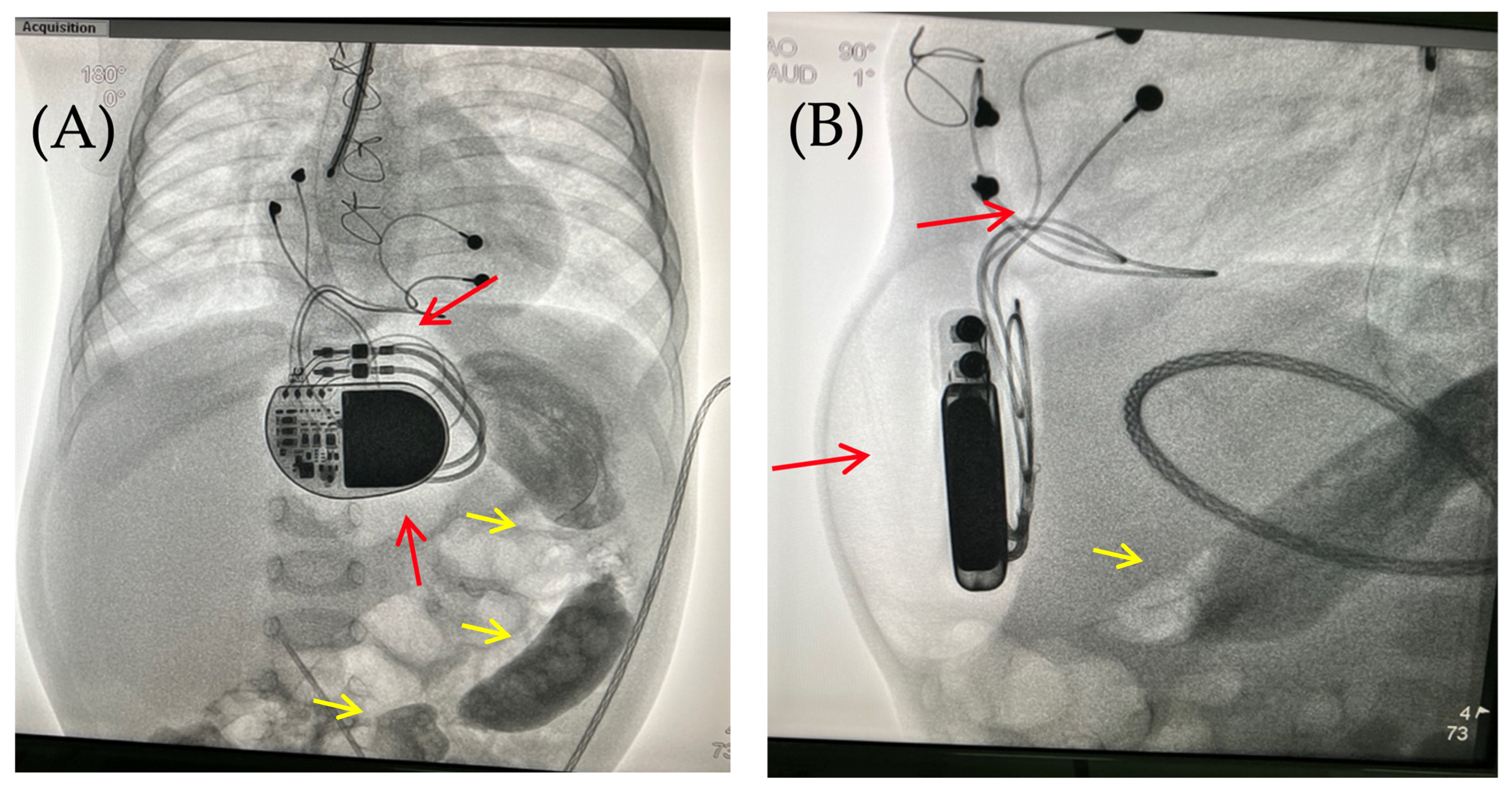 Children 13 00018 g004