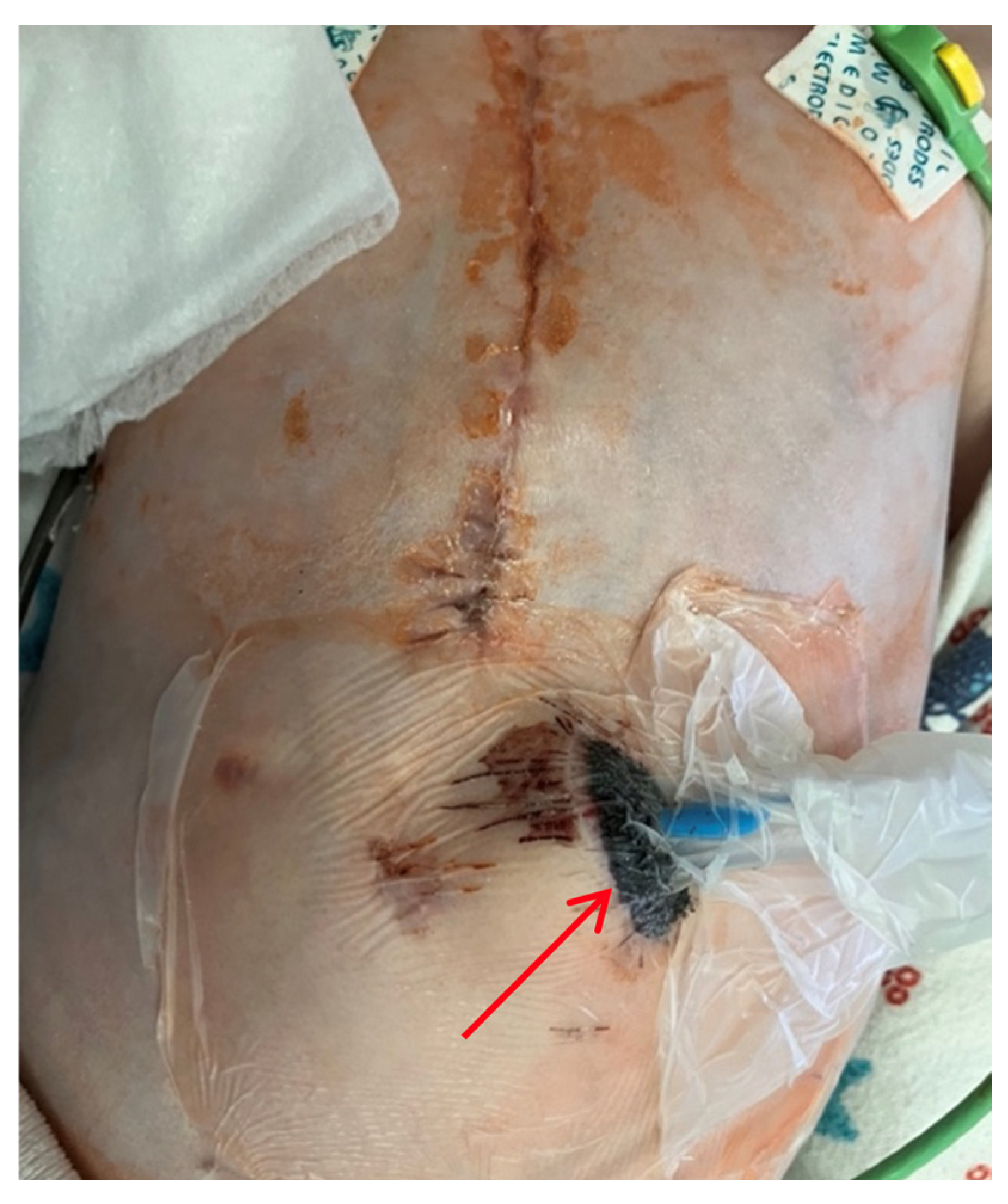 Children 13 00018 g005