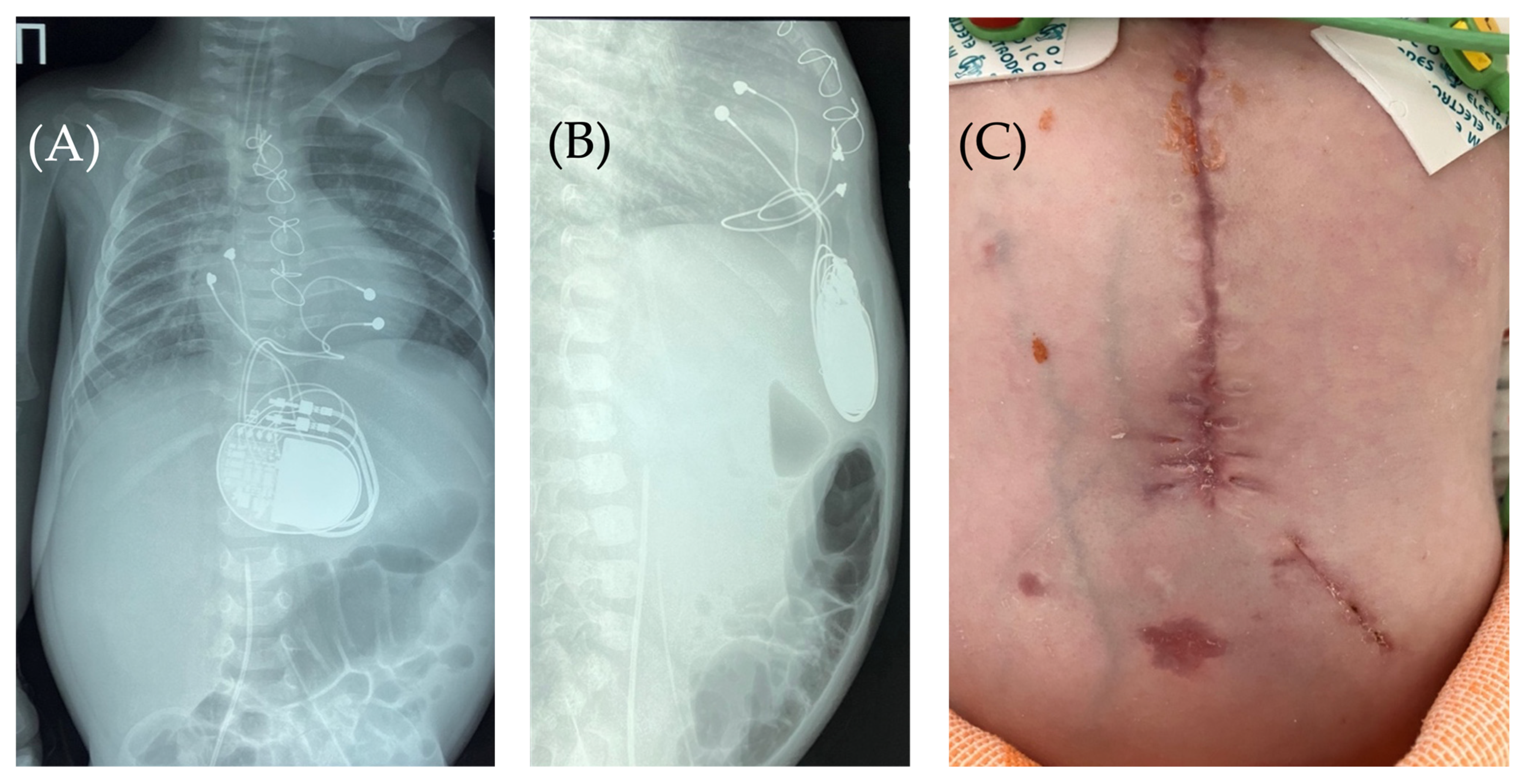 Children 13 00018 g006