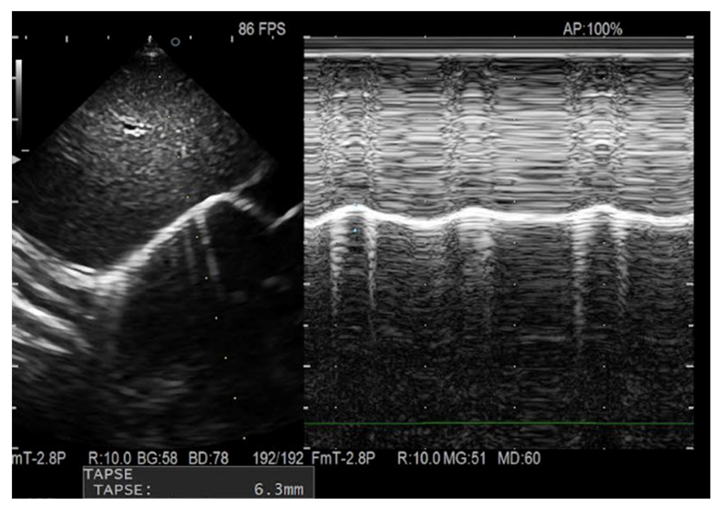 Children 13 00024 g002