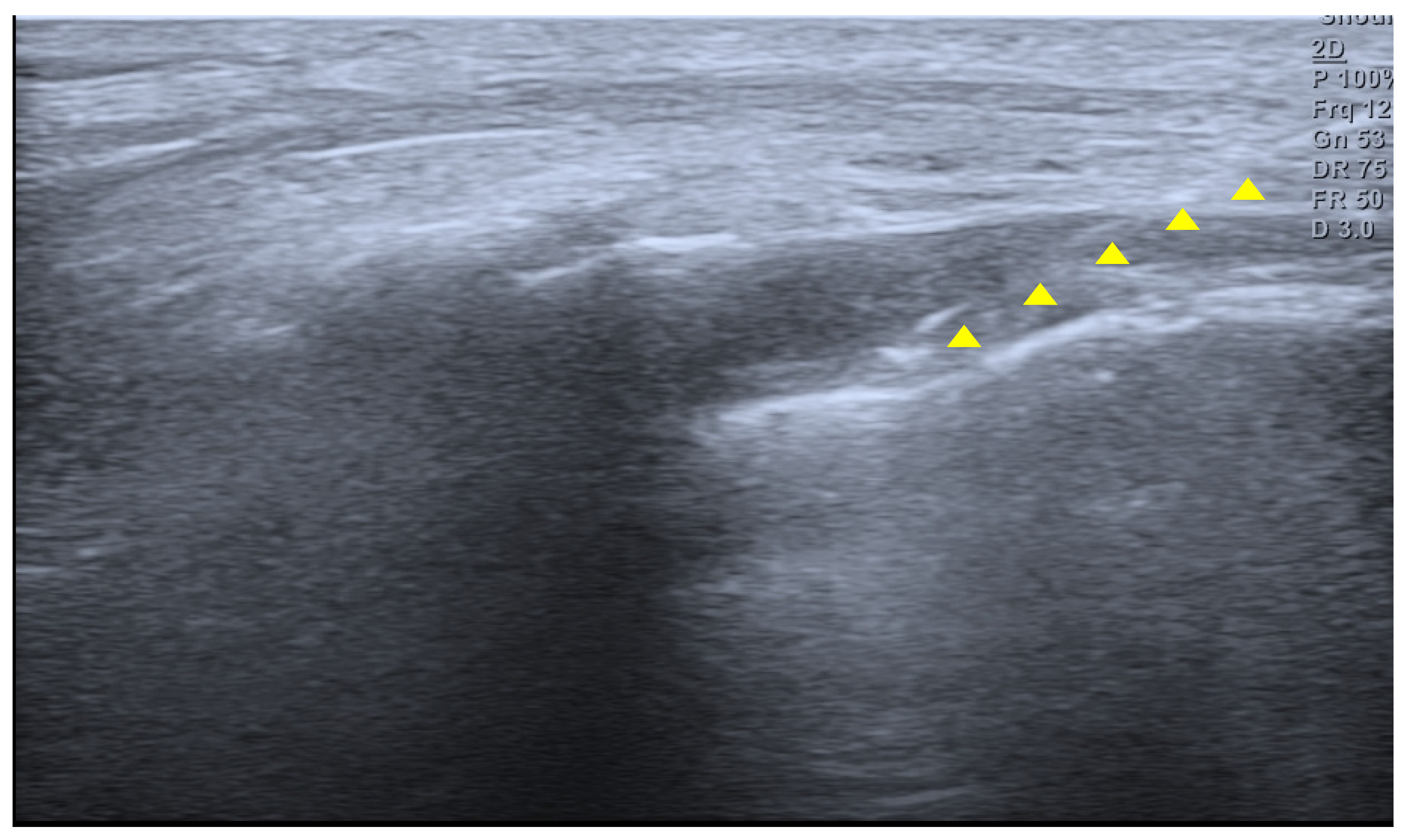 Children 13 00033 g002