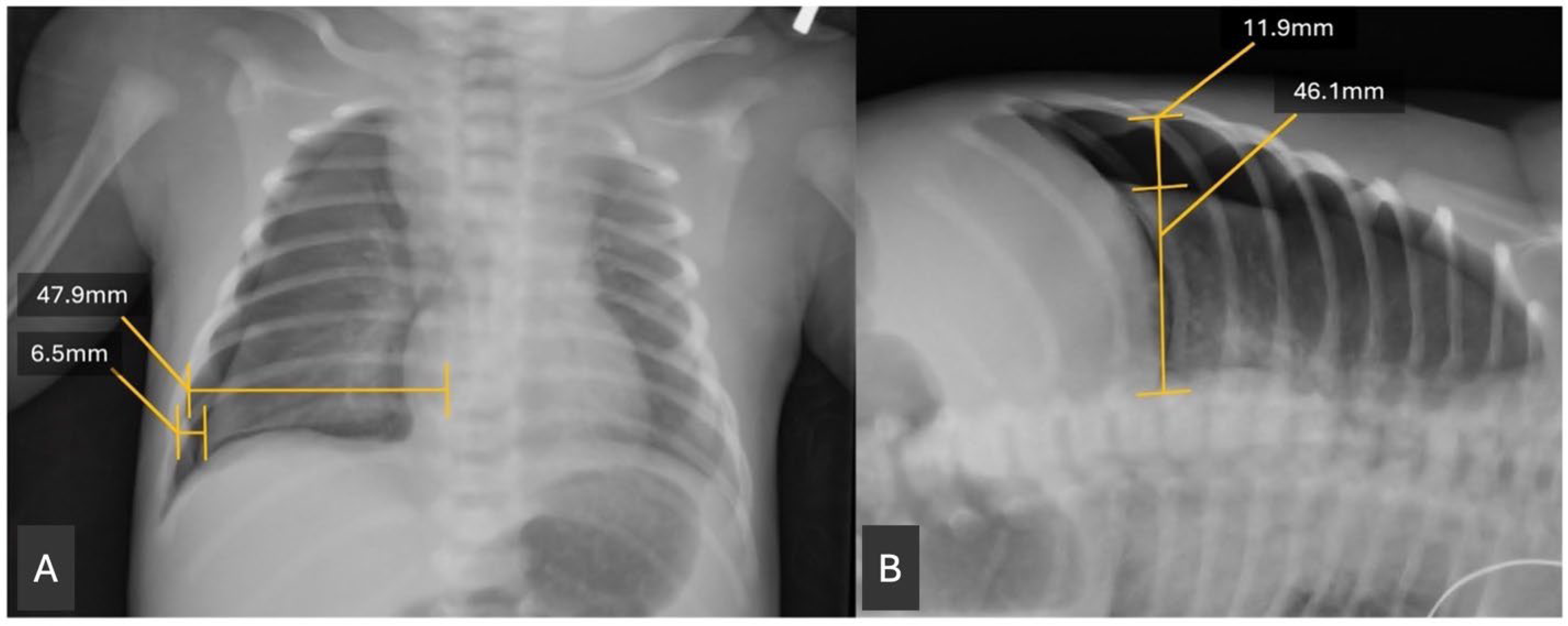 Children 13 00041 g001