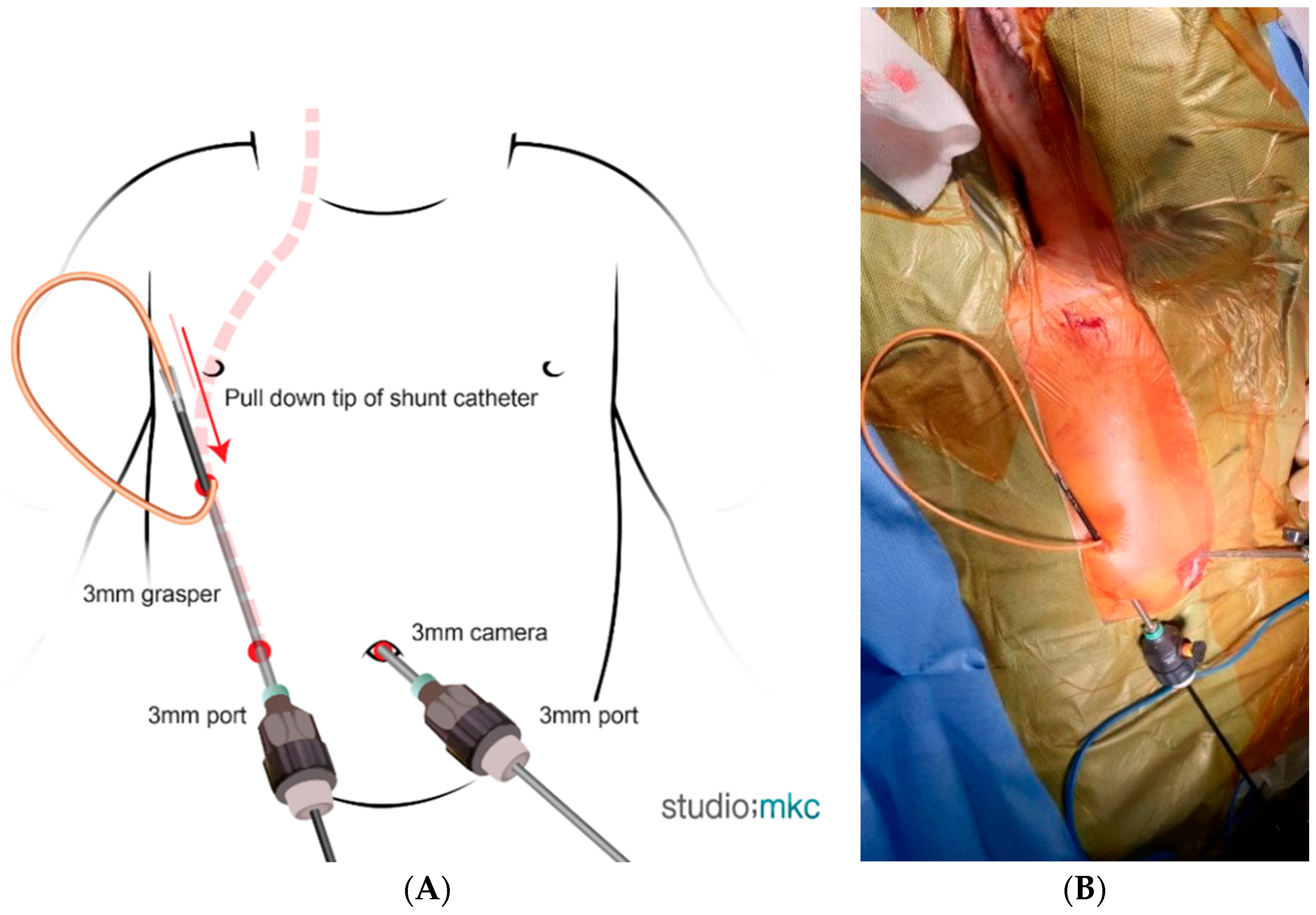 Children 13 00072 g002