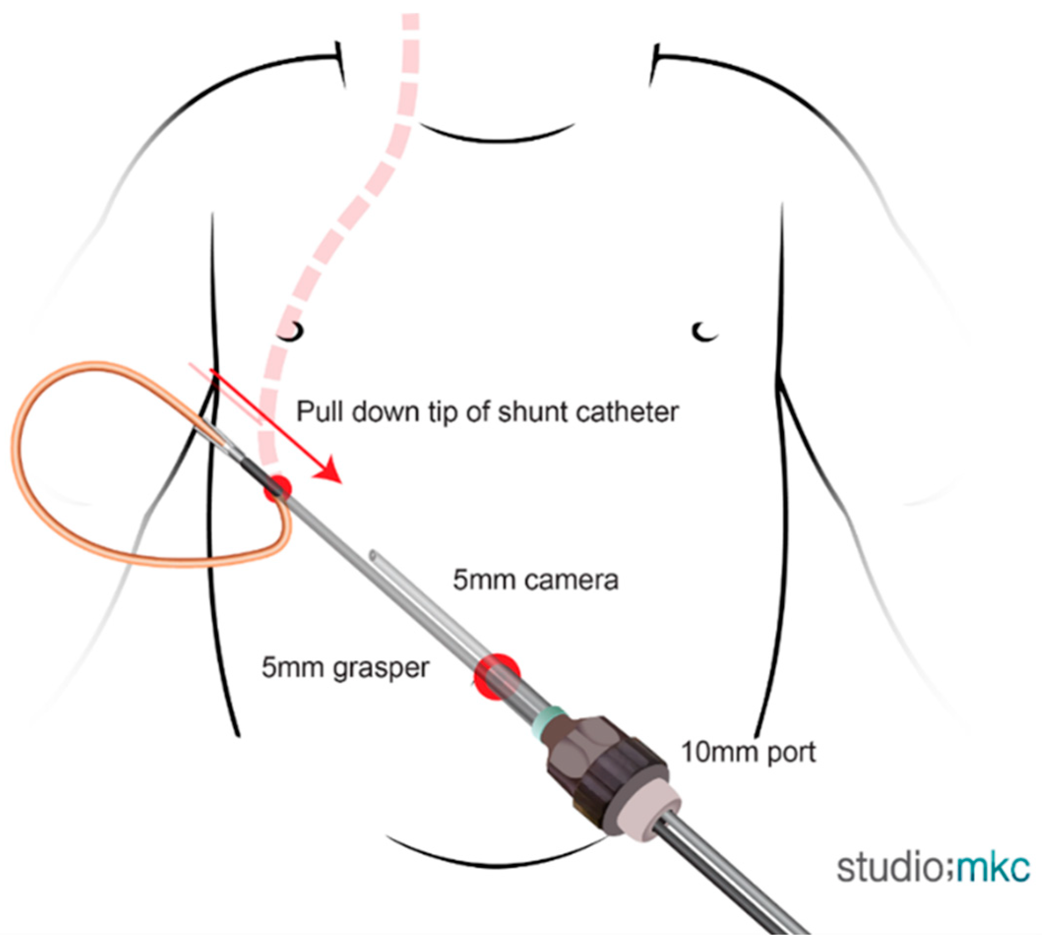 Children 13 00072 g003