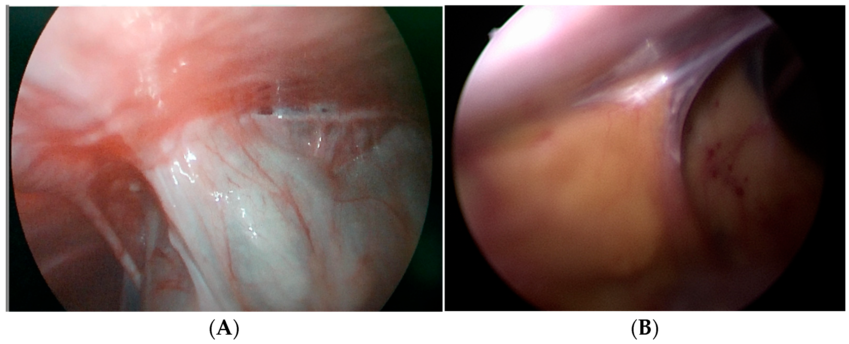 Children 13 00072 g004