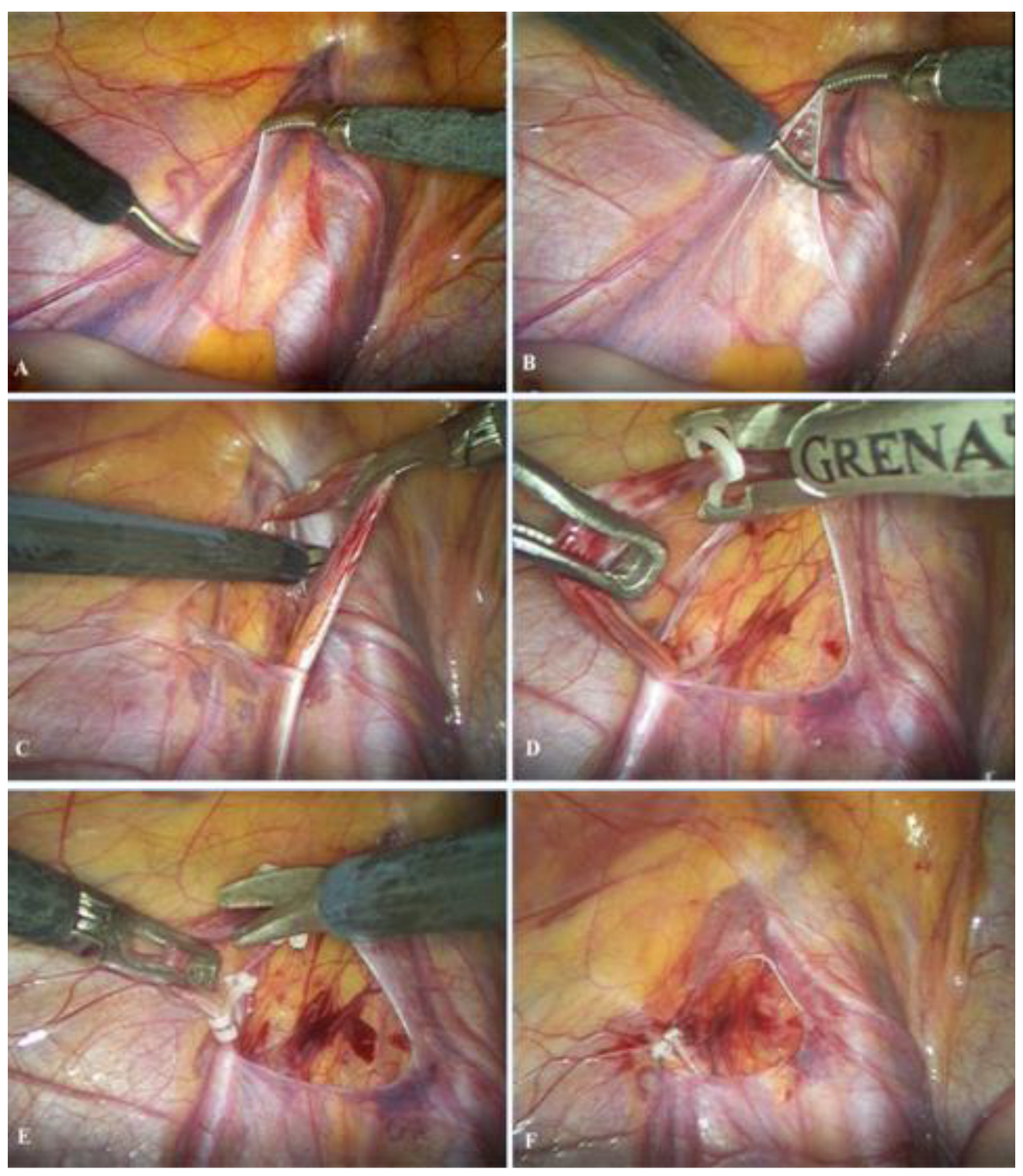 Children 13 00077 g002 Children 13 00077 g002