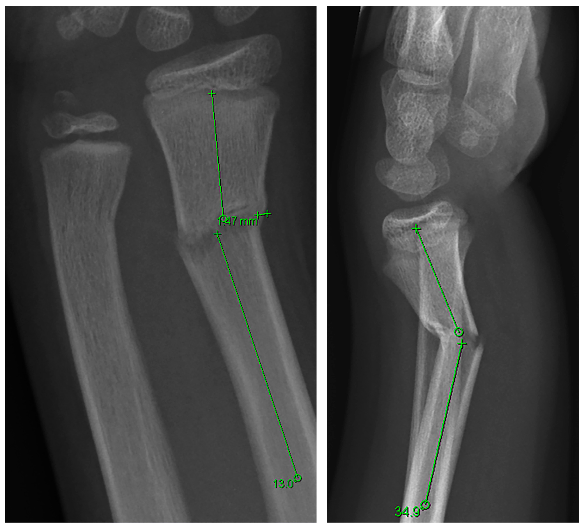 Children 13 00098 g001 Children 13 00098 g001