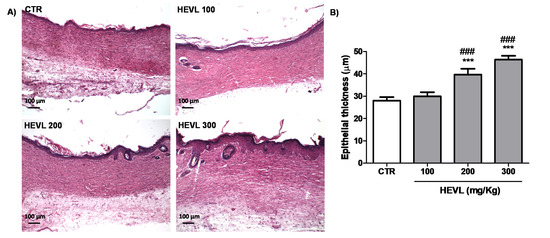 Histological Evidence of Wound Healing Improvement in Rats