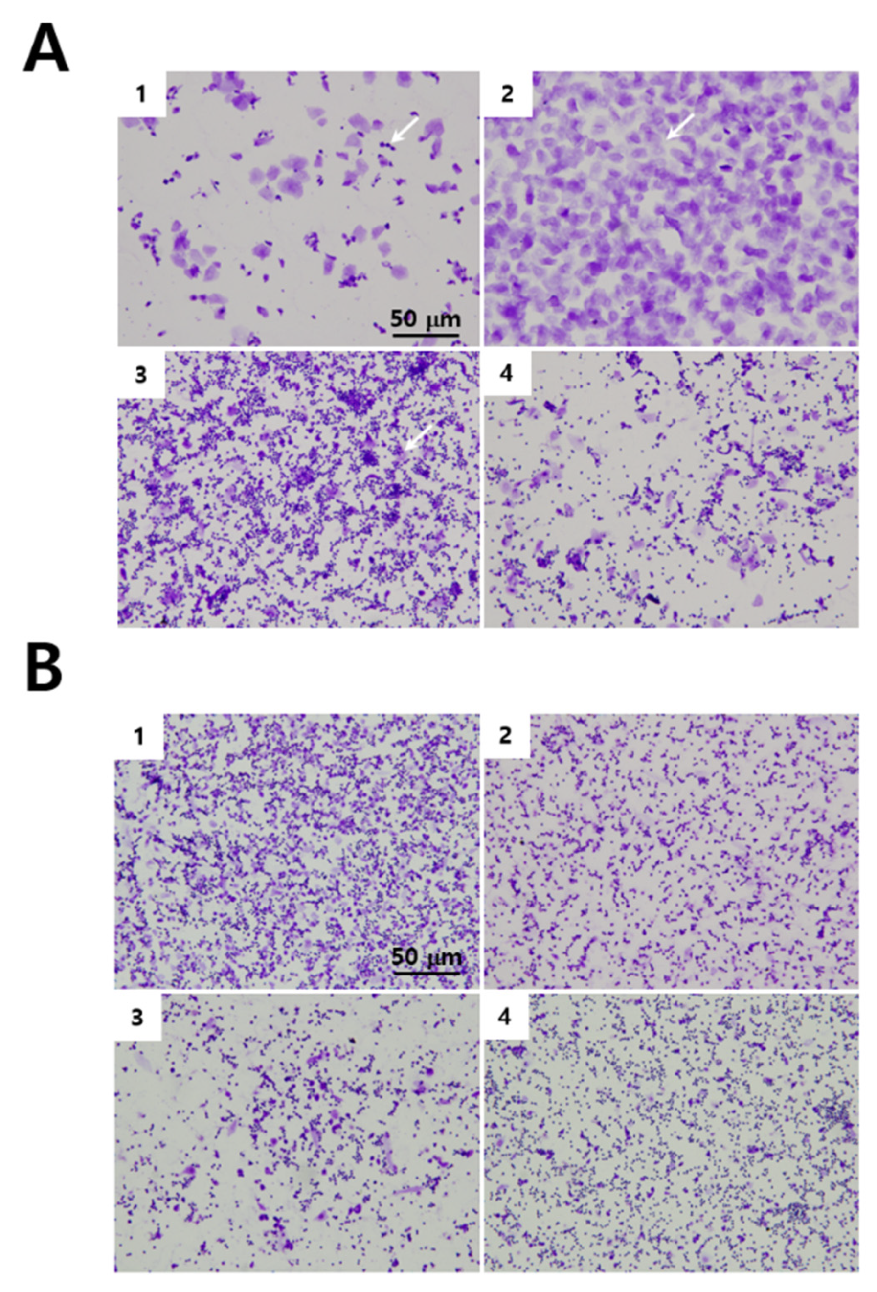 Effects of Radix Polygalae on Cognitive Decline and