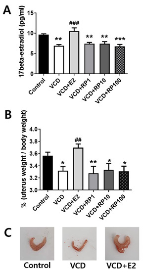Critical transitions in Chinese dunes during the past 12,000