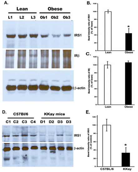 Reduced Tyrosine and Serine-632 Phosphorylation of Insulin Receptor ...