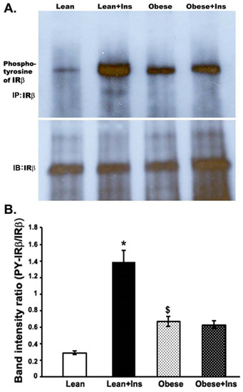 Reduced Tyrosine and Serine-632 Phosphorylation of Insulin Receptor ...