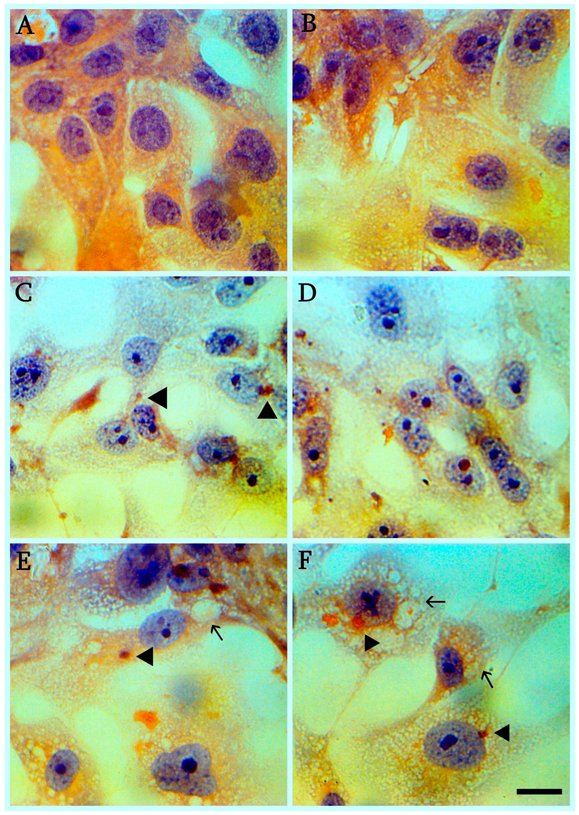 Cimb 45 00019 g002 Cimb 45 00019 g002