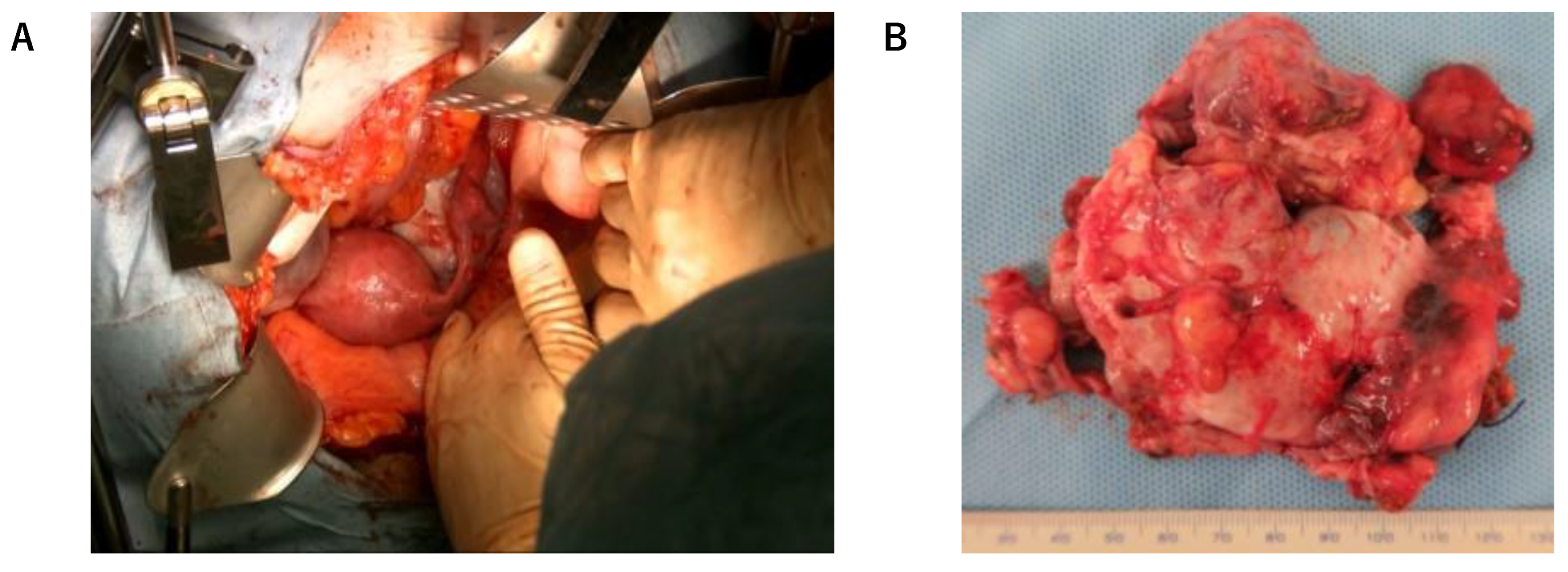 Cimb 45 00118 g002 Cimb 45 00118 g002