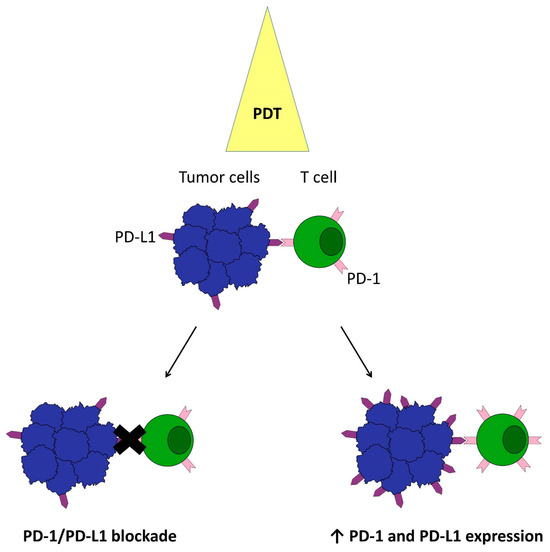 The Latest Look at PDT and Immune Checkpoints The Latest Look at PDT and Immune Checkpoints