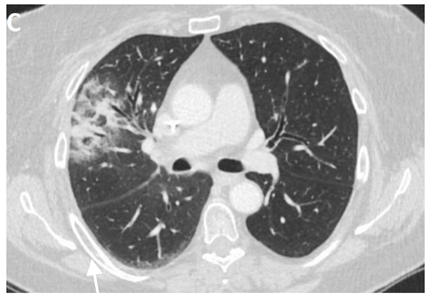 Clinpract 11 00056 i002