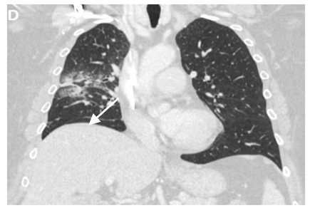 Clinpract 11 00056 i003