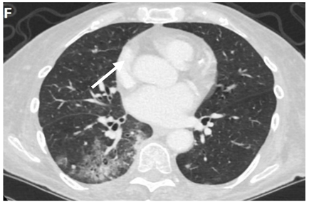 Clinpract 11 00056 i005