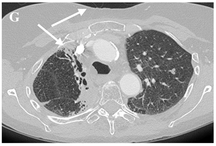 Clinpract 11 00056 i006