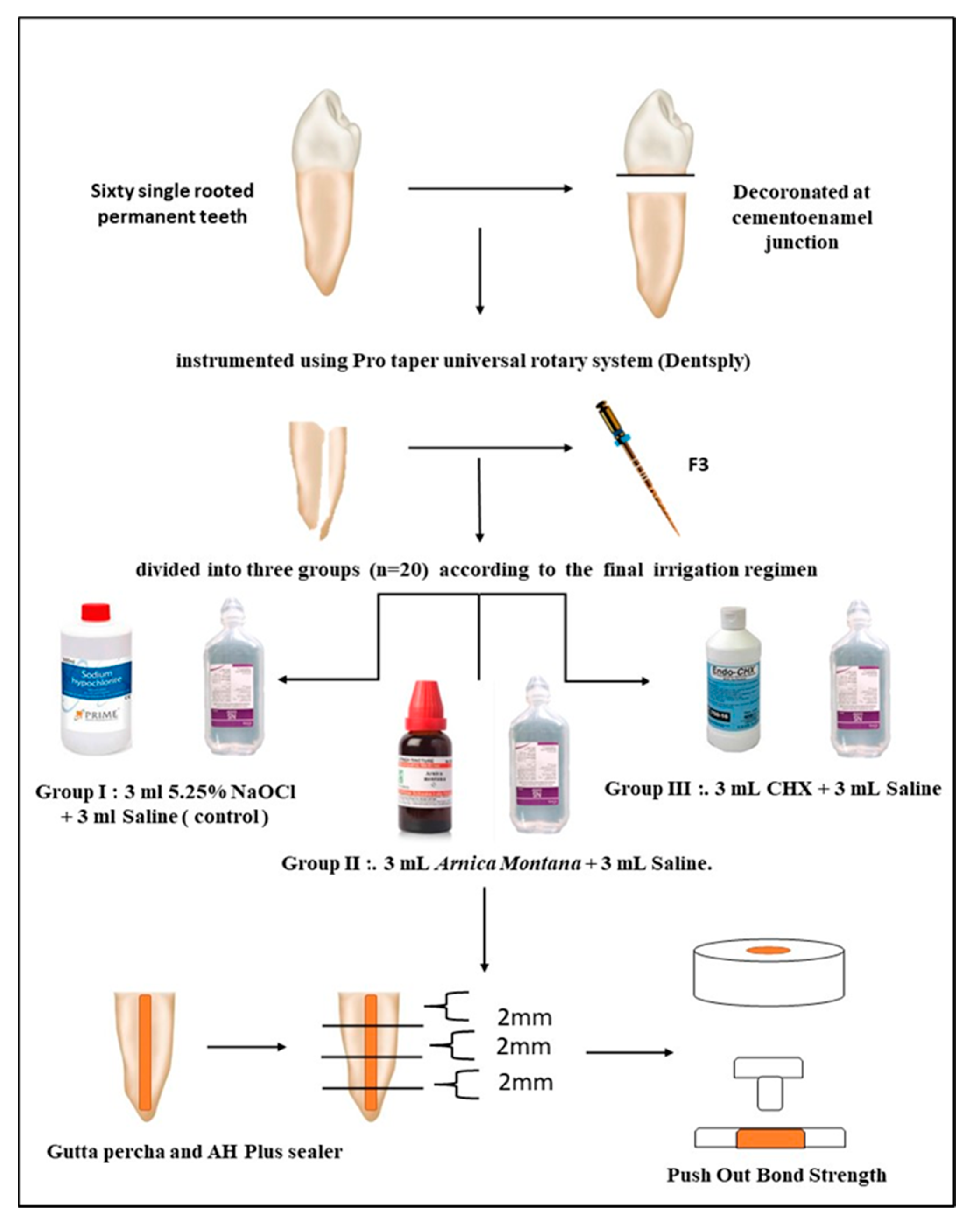 Clinics and Practice Free FullText Pushout Bond Strength of Root Fillings after Irrigation